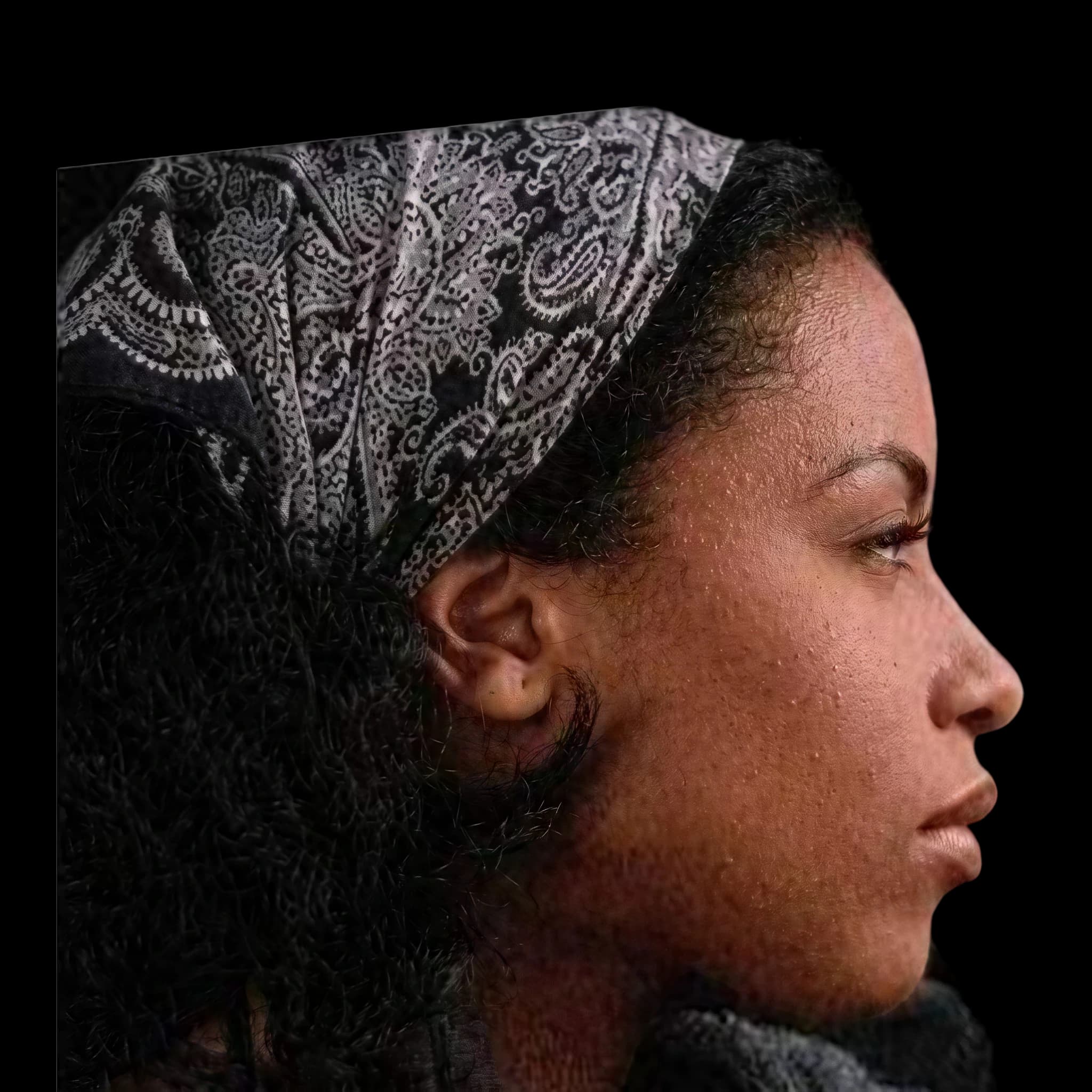 Aaliyah Haughton, Upper Lip E-Line Position