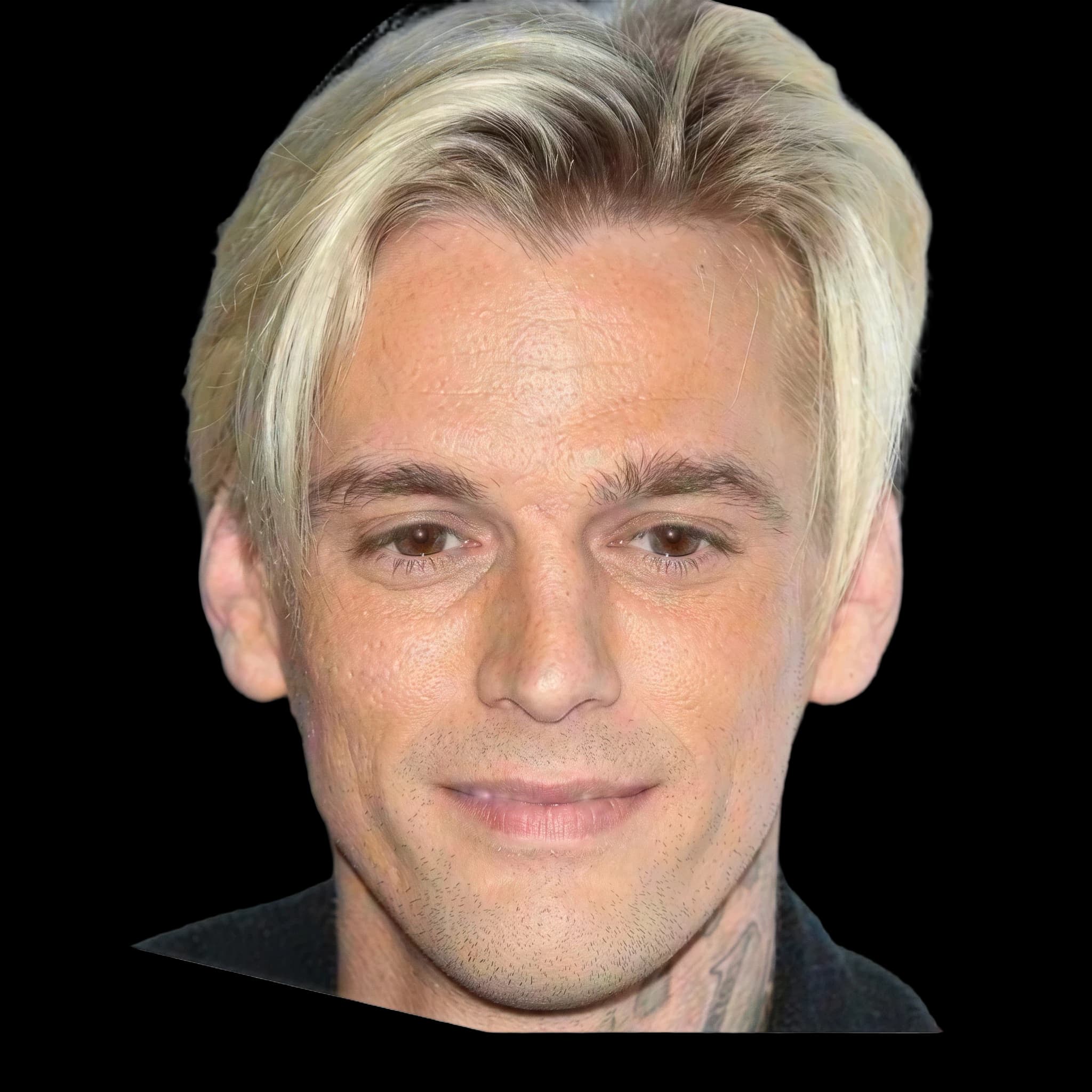 Aaron Carter, Hyperpigmentation