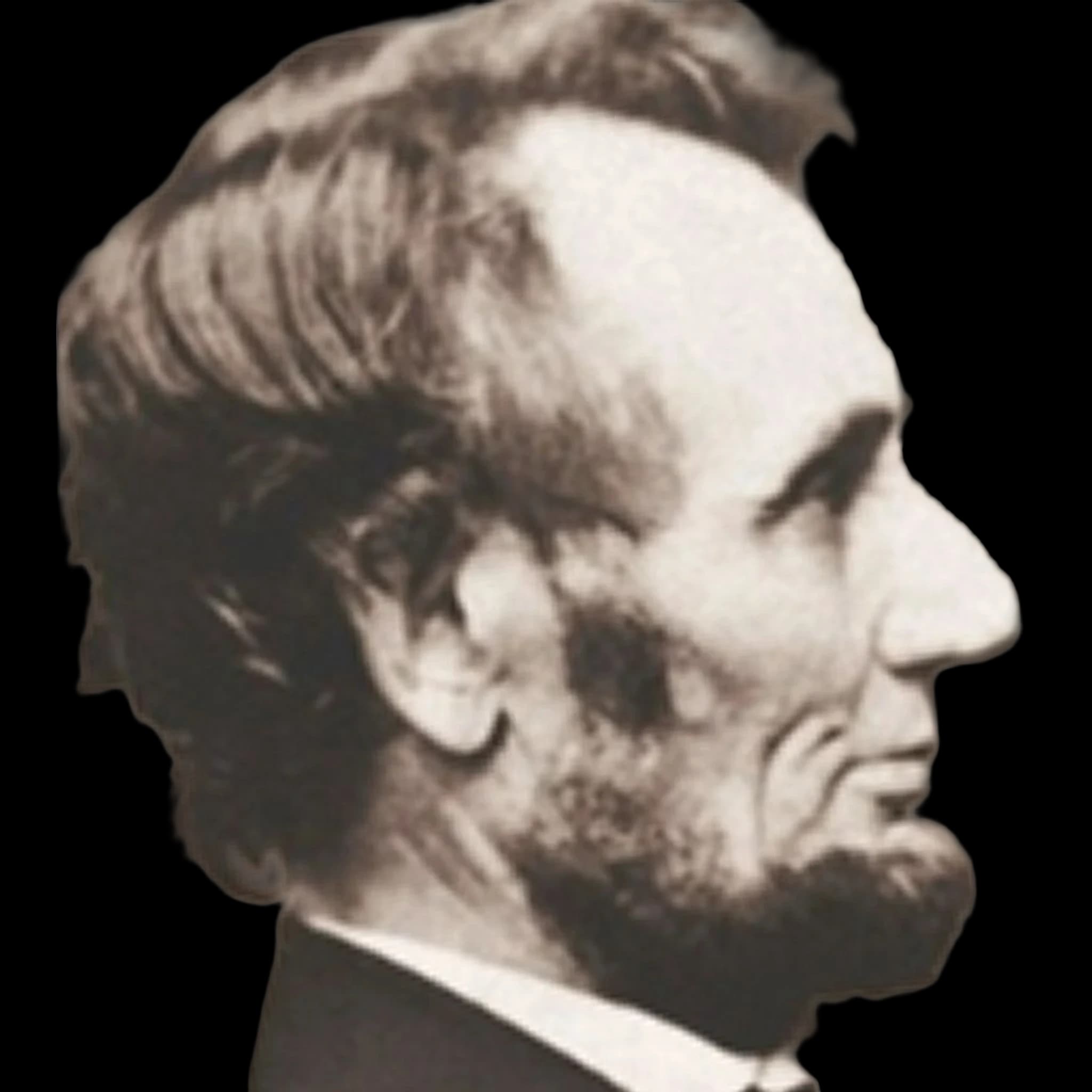 Abraham Lincoln, Mandibular Plane Angle