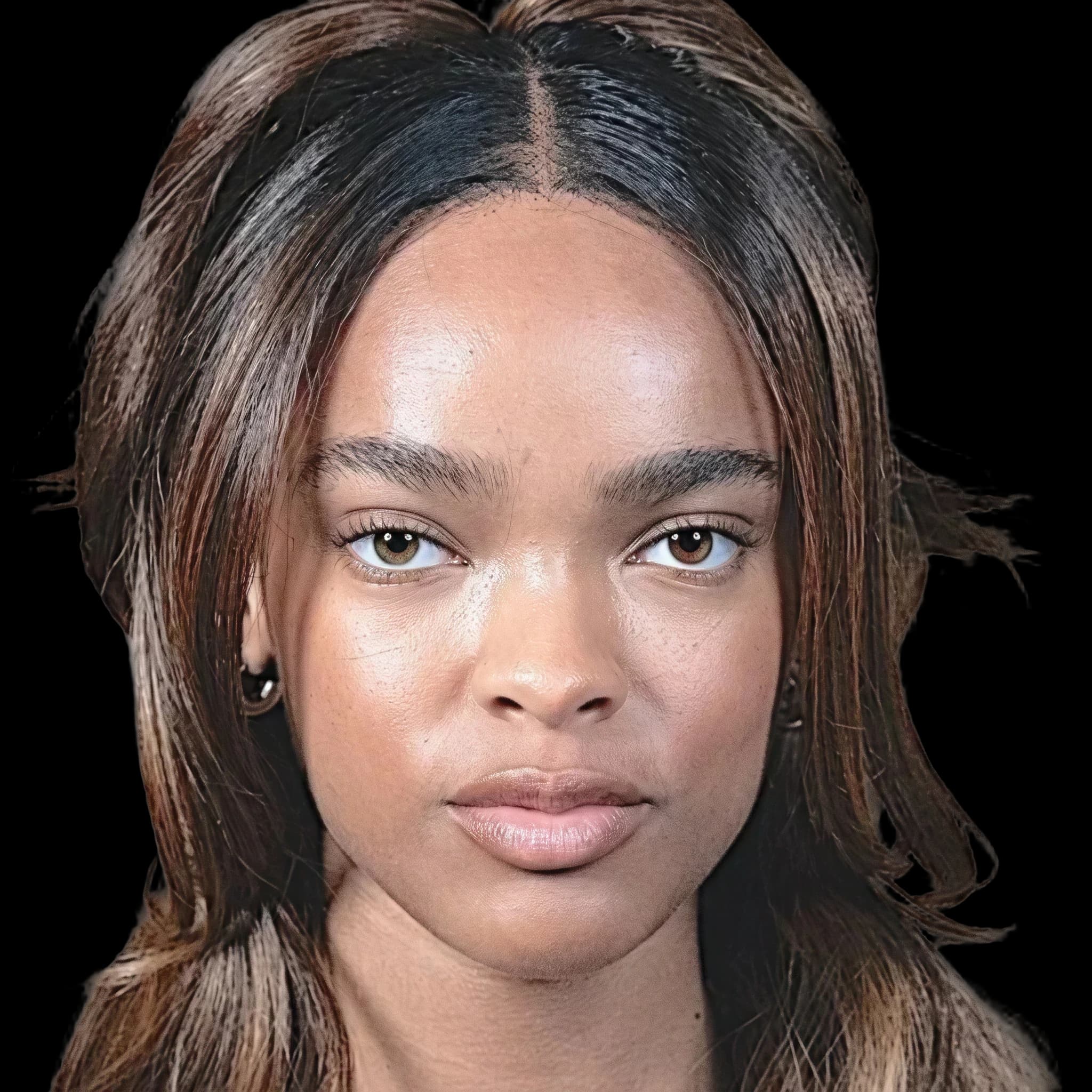 Akira Jackson, Hyperpigmentation