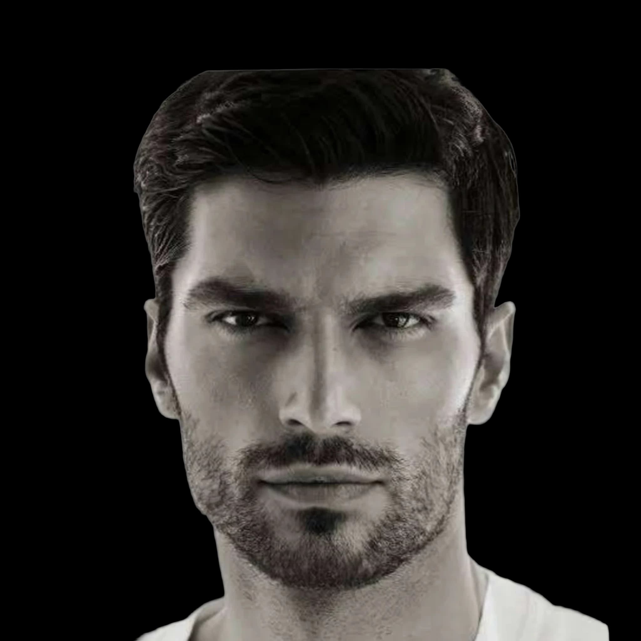 Aleksa Gavrilovic, Hyperpigmentation