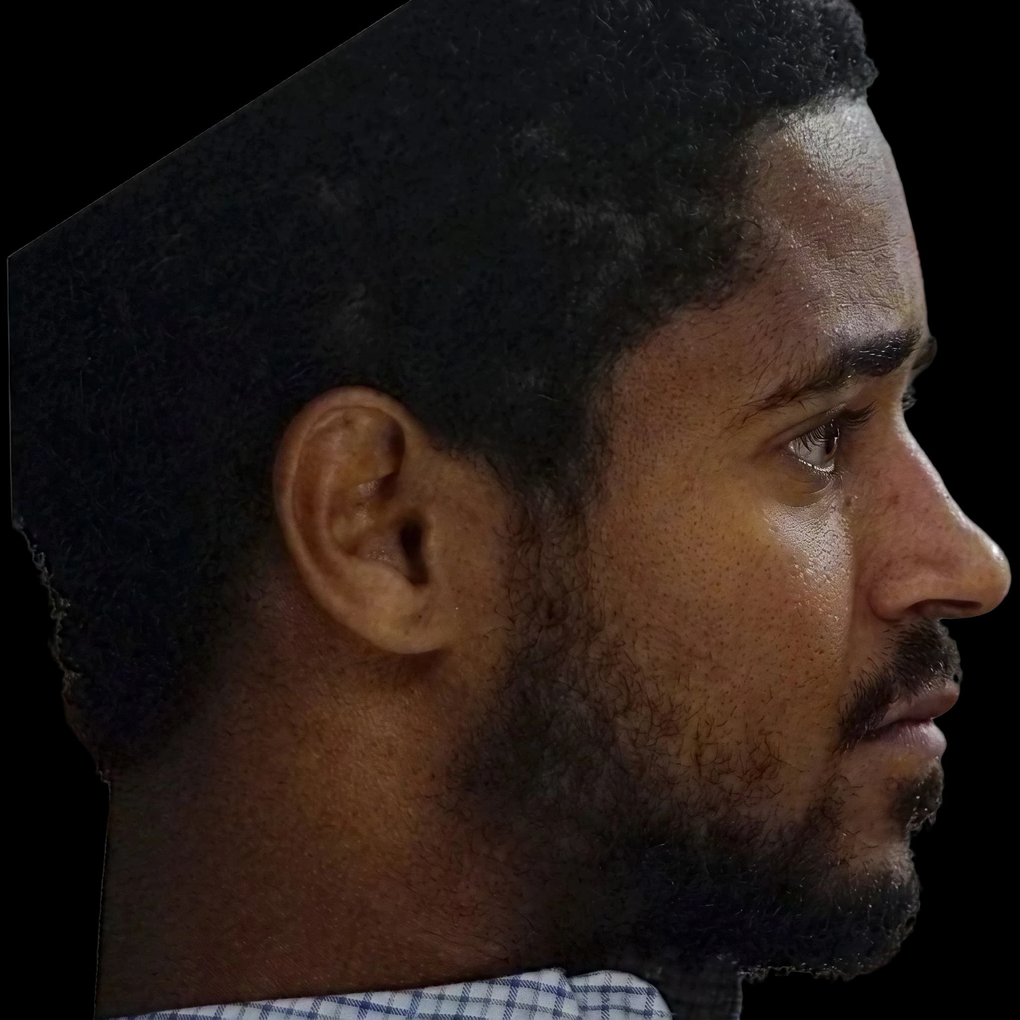 Alfred Enoch, Mandibular Plane Angle