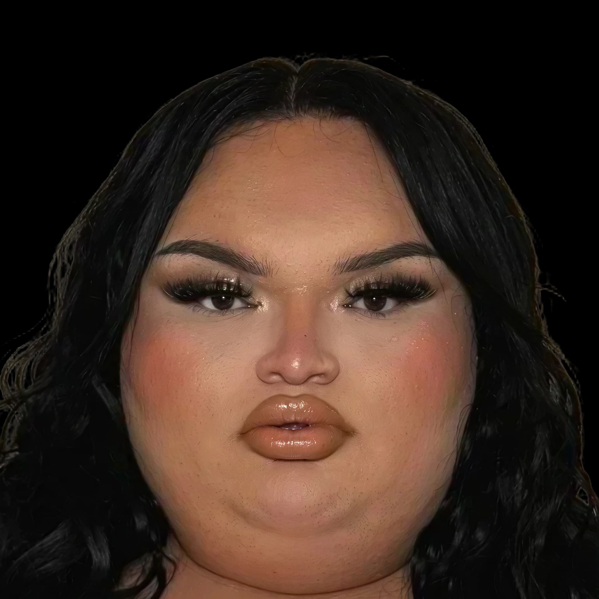 Ali C. Lopez, Hyperpigmentation