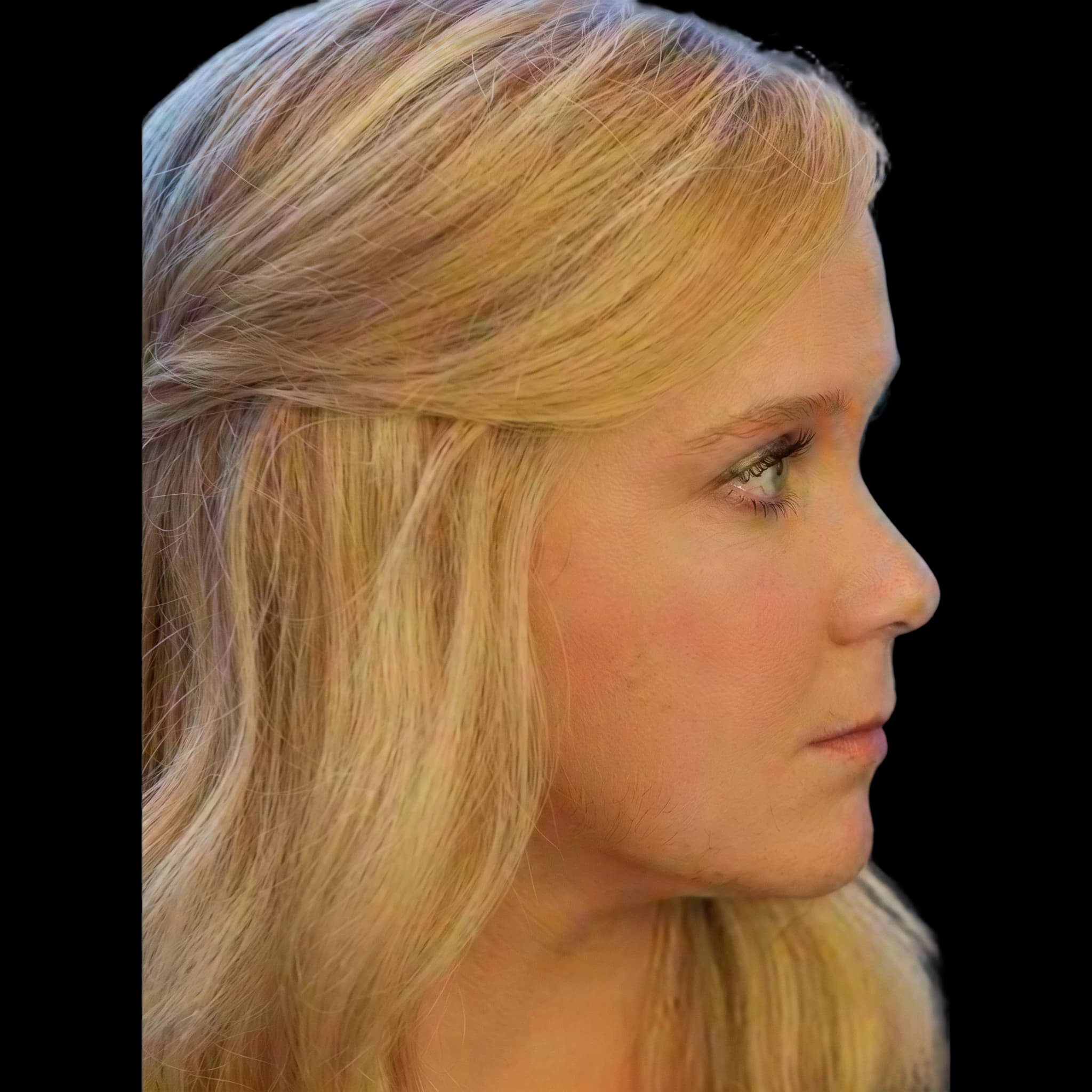 Amy schumer, Browridge Inclination Angle