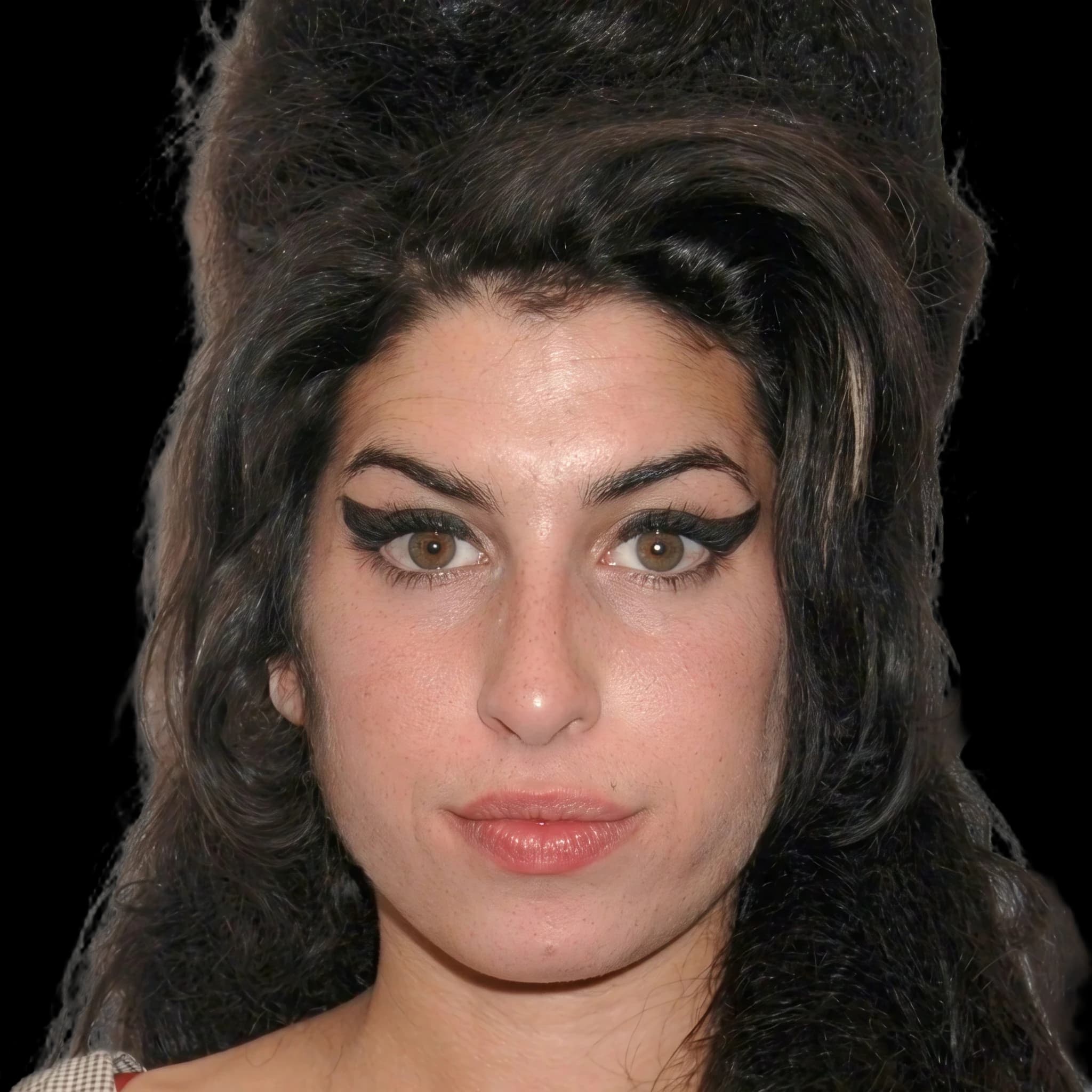 Amy Winehouse, Hypopigmentation