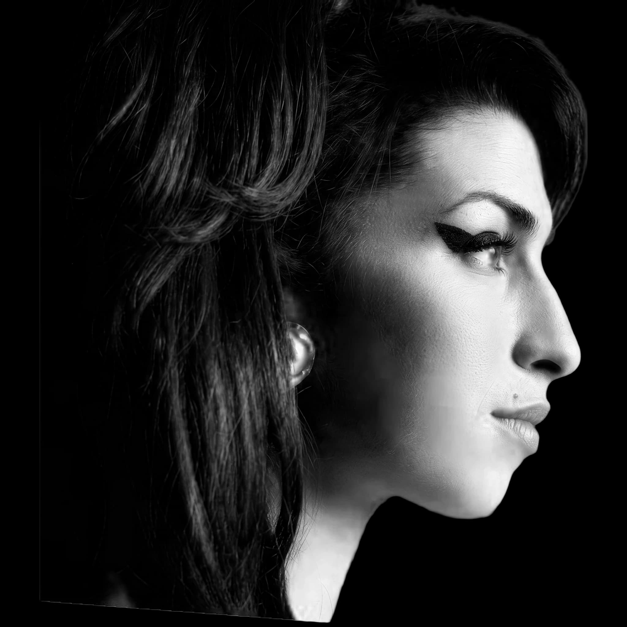 Amy Winehouse, Eye Protrusion