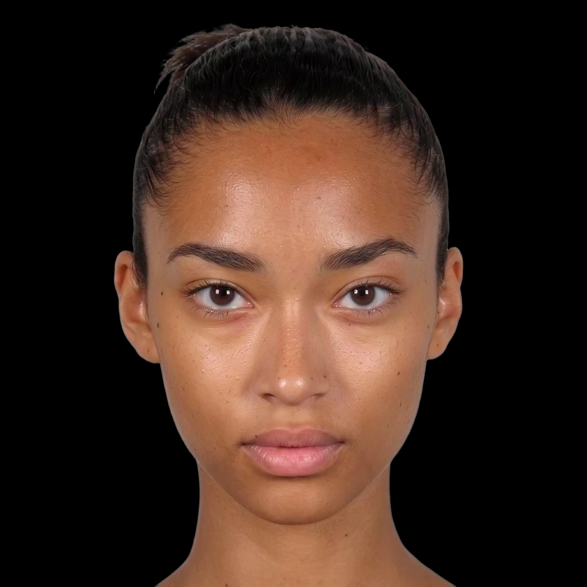 Anais Mali, Acne Scars