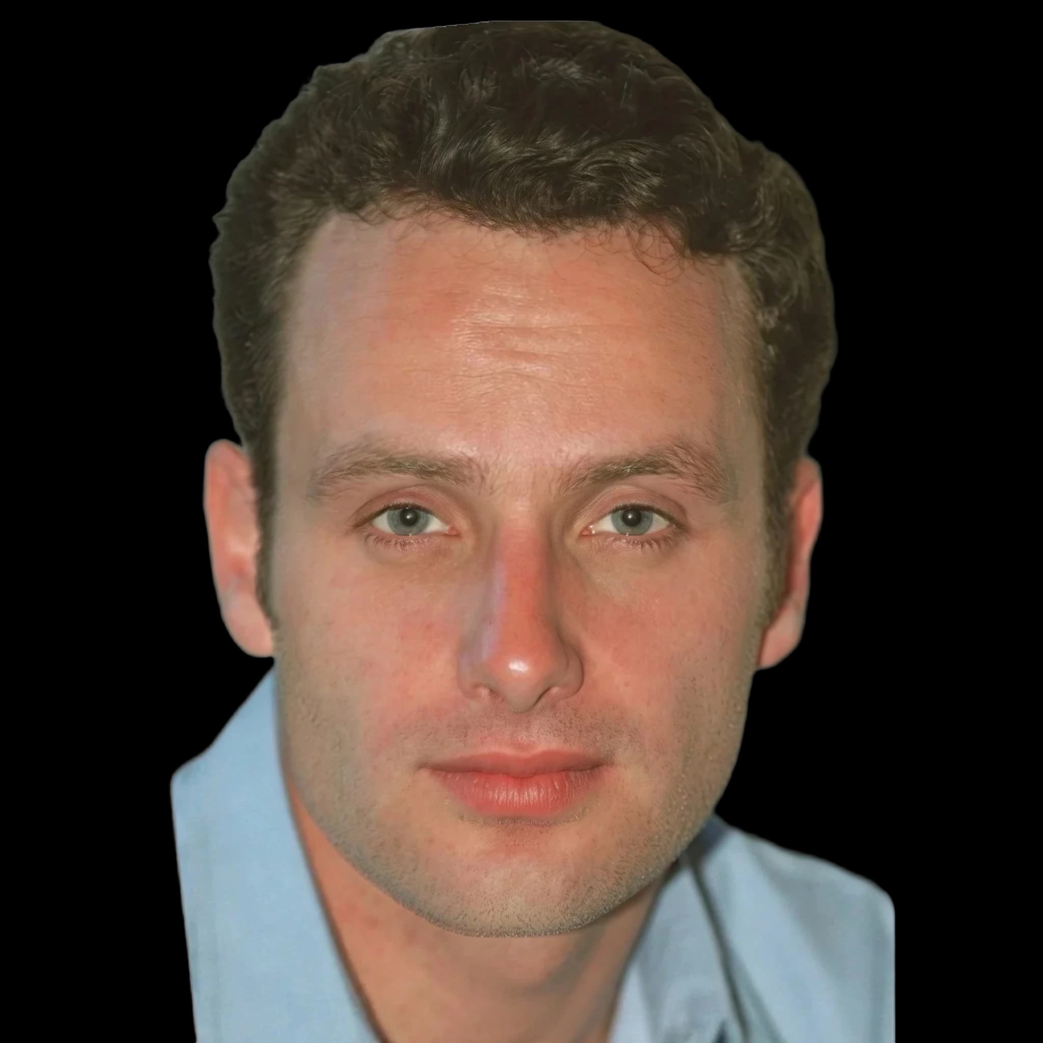 Andrew Lincoln, Hyperpigmentation