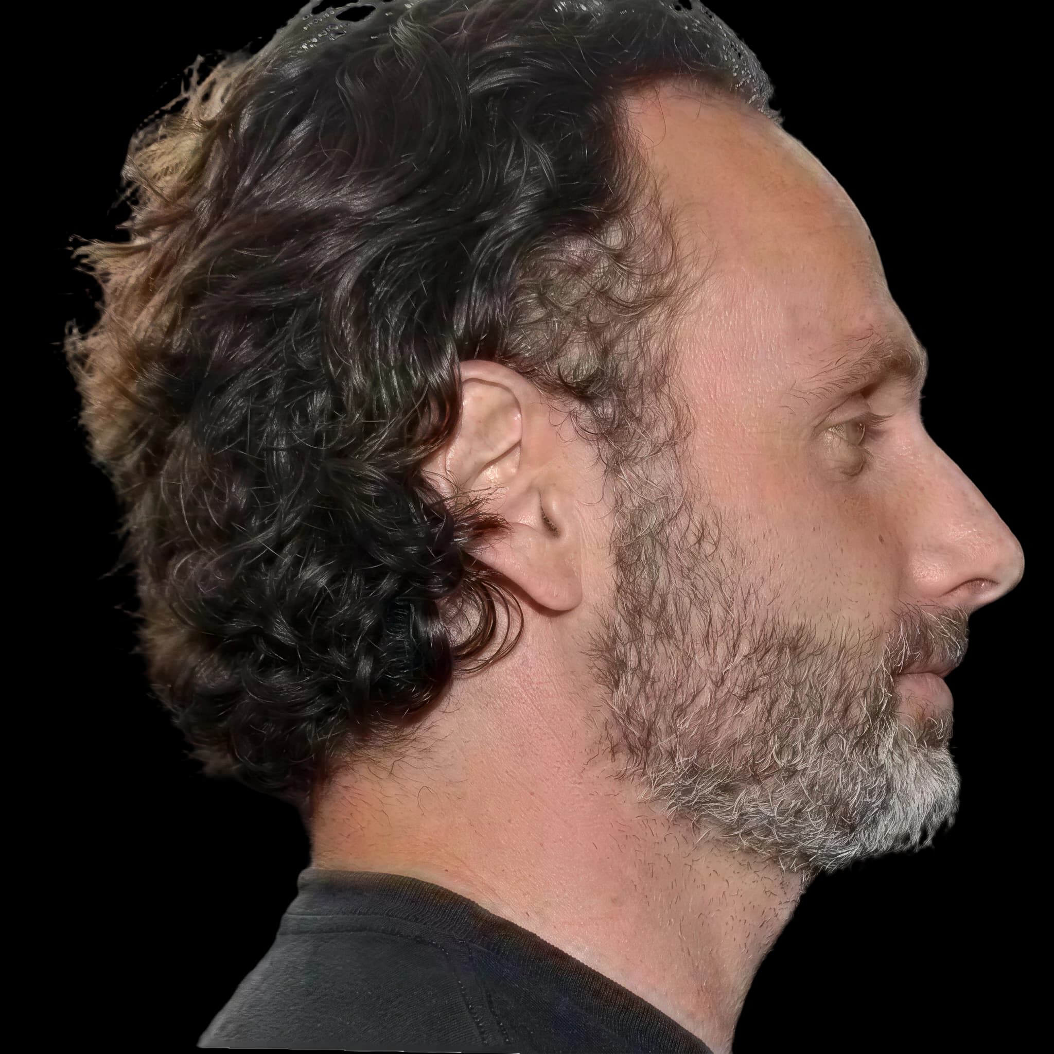 Andrew Lincoln, Submental Definition