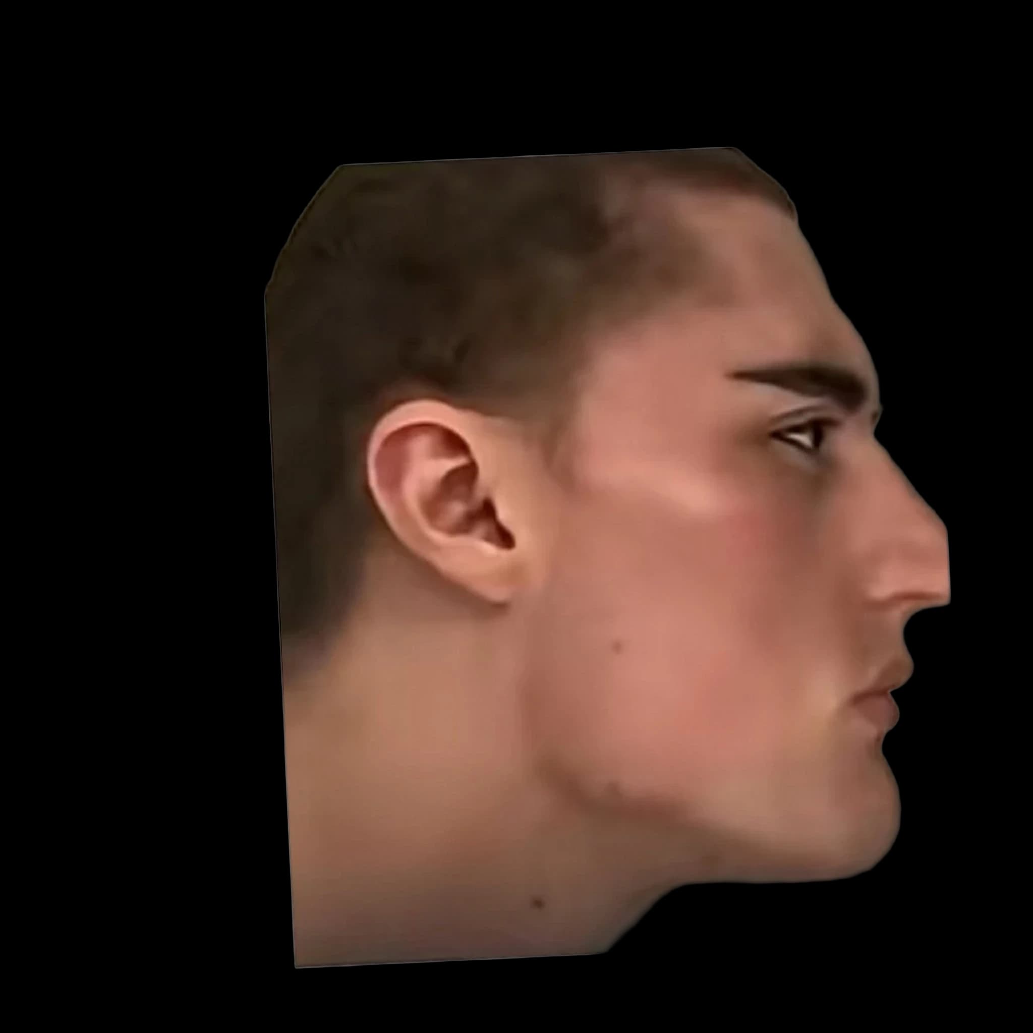 Androgenic, Gonial Angle