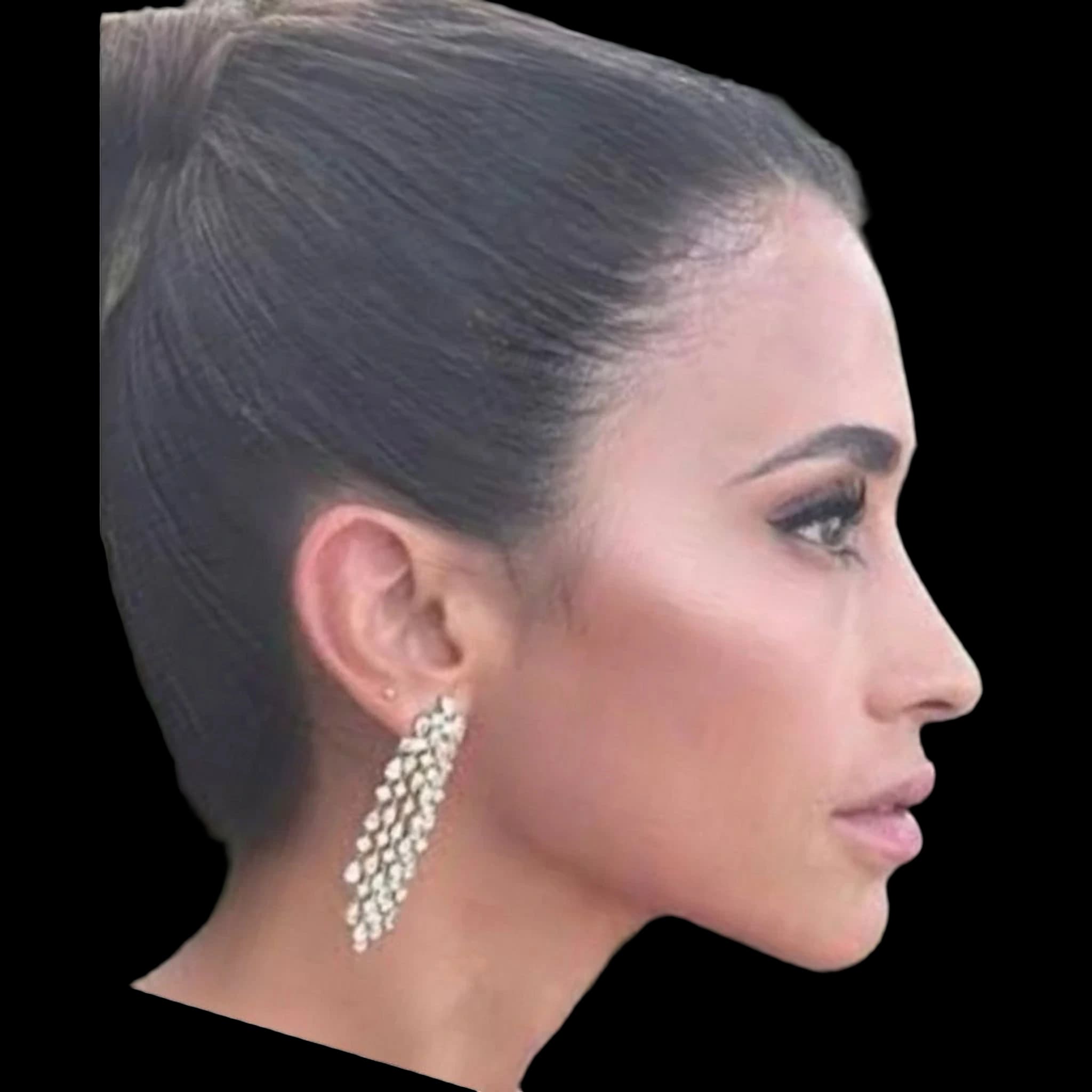 Antonela Roccuzzo, Submental Definition