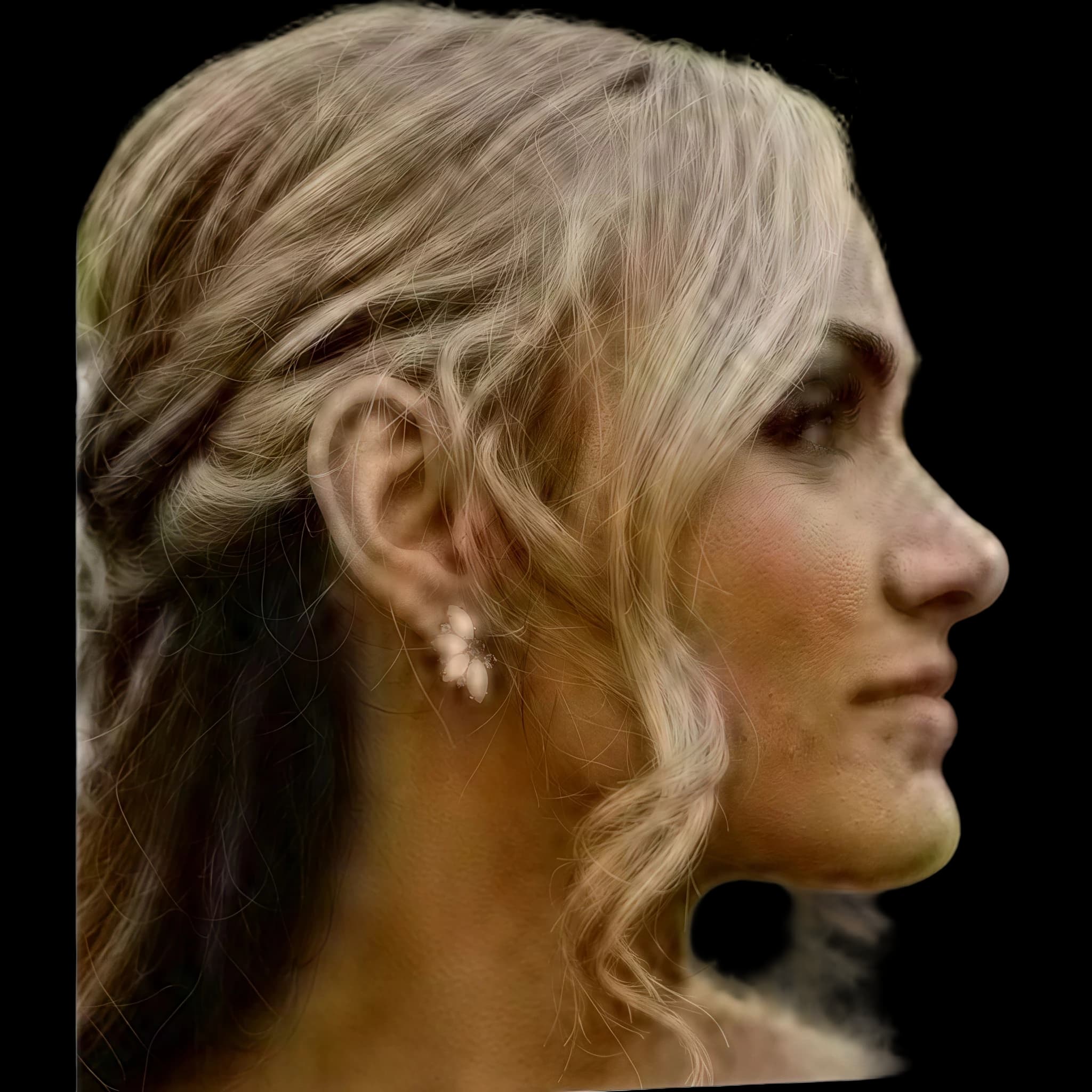 Ariana Lee Bonfiglio, Submental Definition