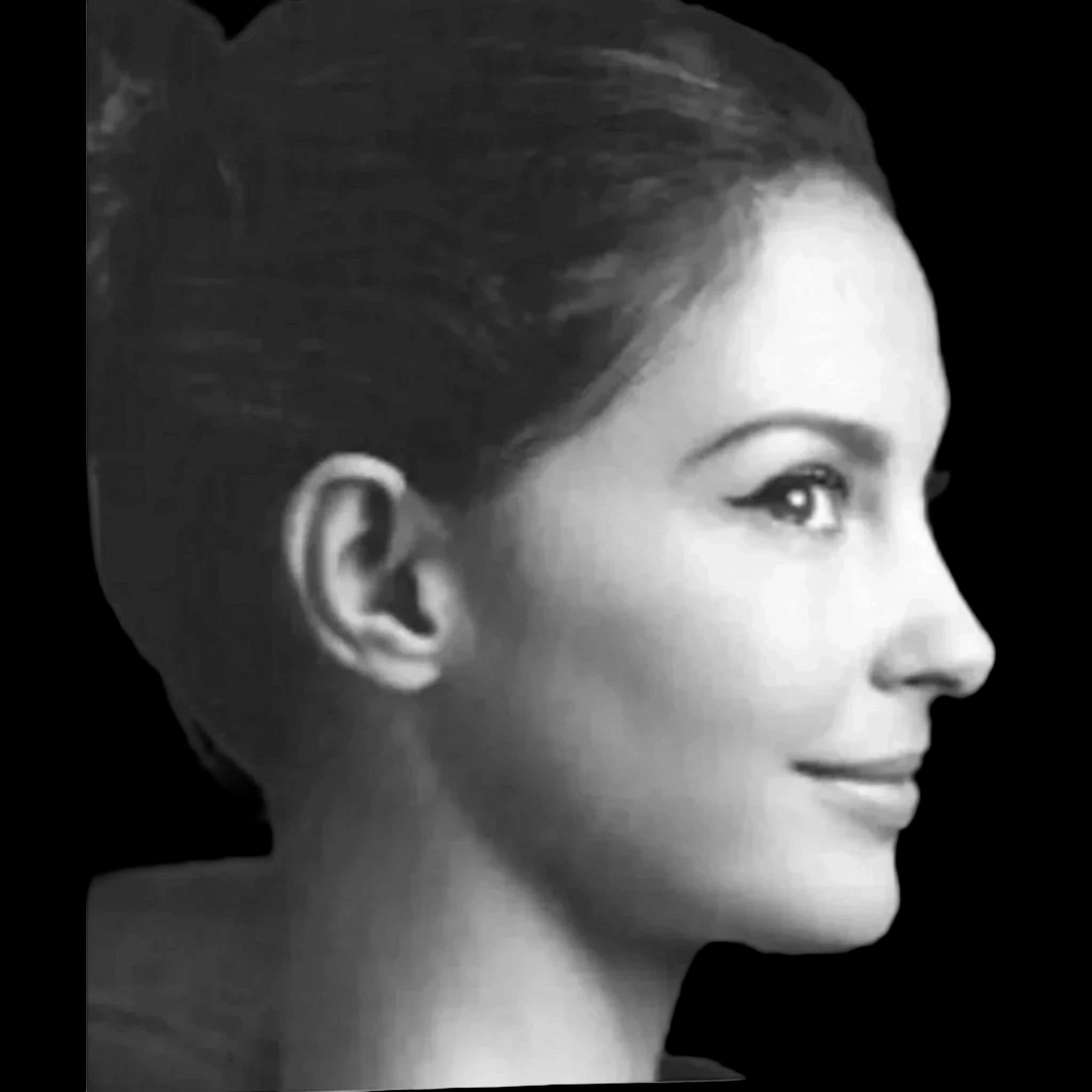 Ashley Judd, Submental Definition