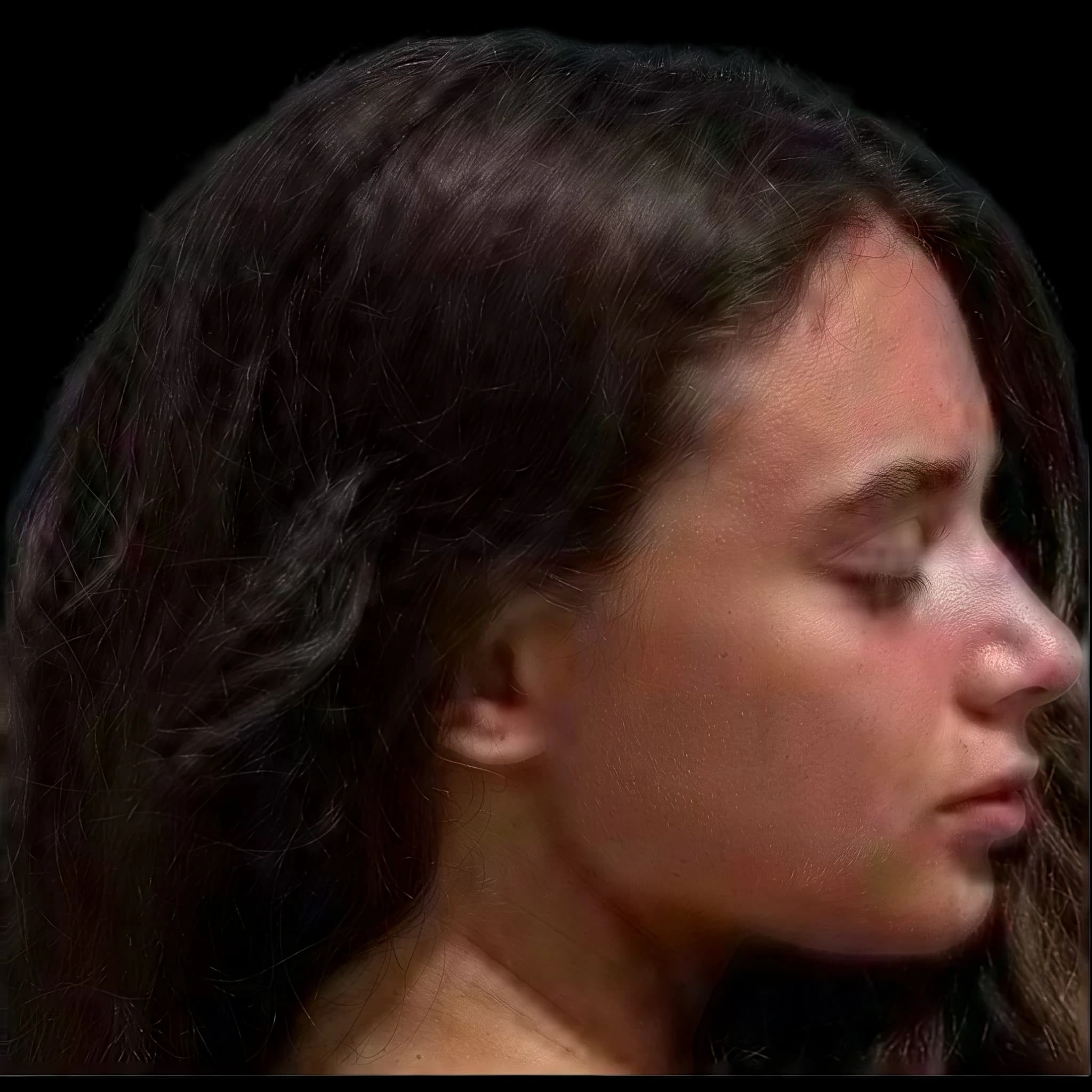 Barbara Marrocco, Nasal Tip Angle