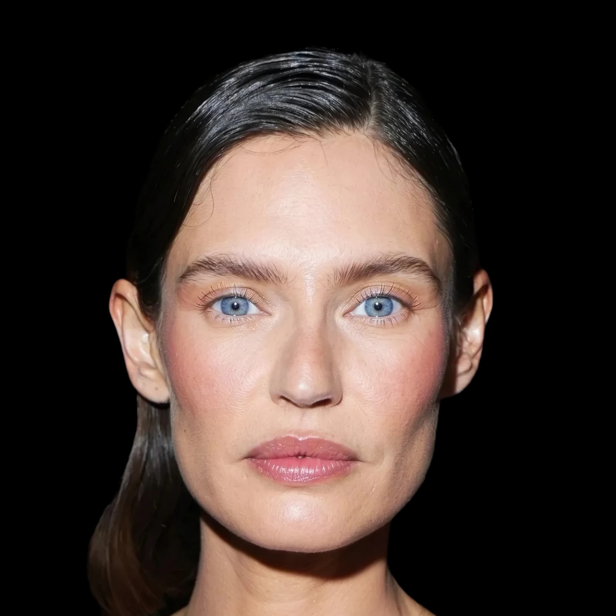 Bianca Balti, Hyperpigmentation