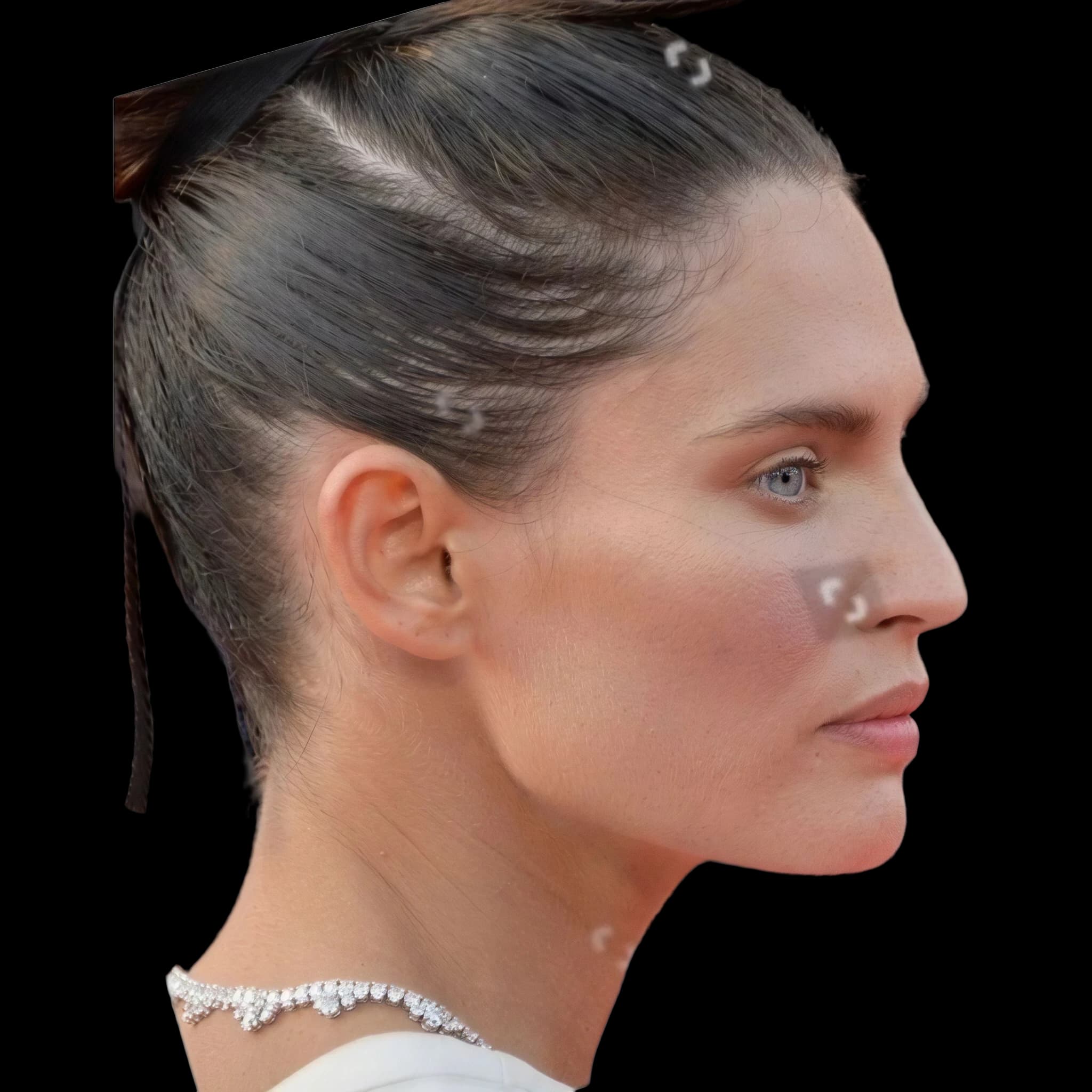 Bianca Balti, Submental Definition