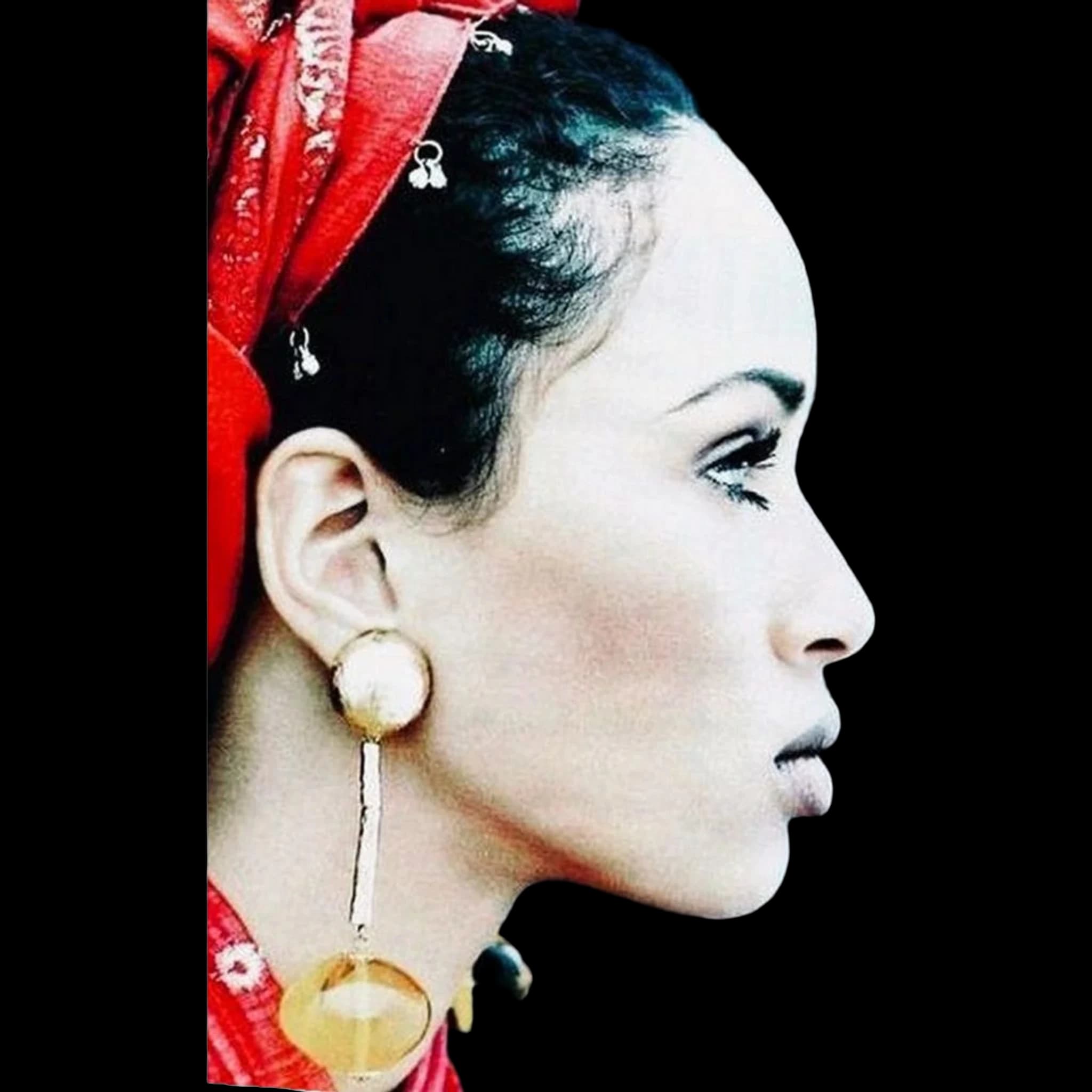 Brandi Quinones, Mandibular Plane Angle