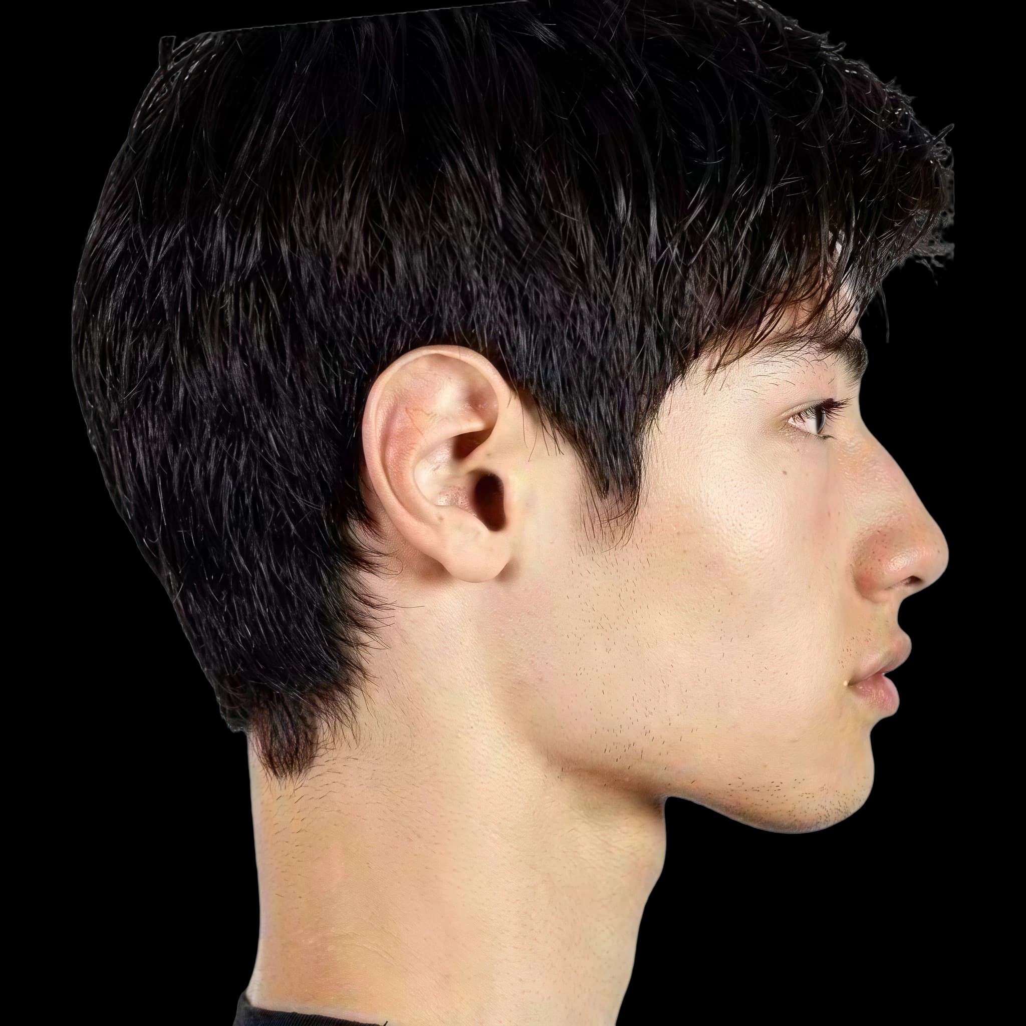 Brando Erba, Submental Definition