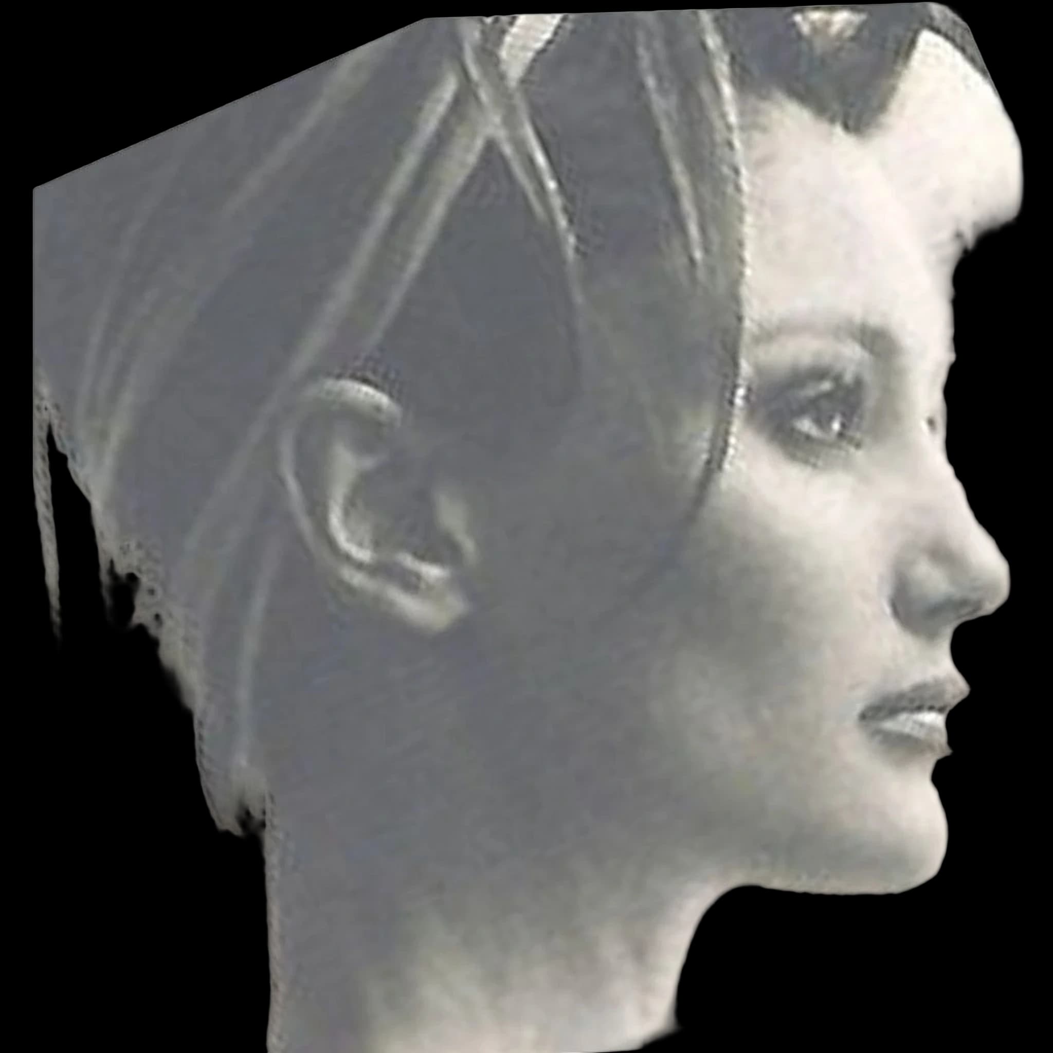 Brenda Schad, Mandibular Plane Angle