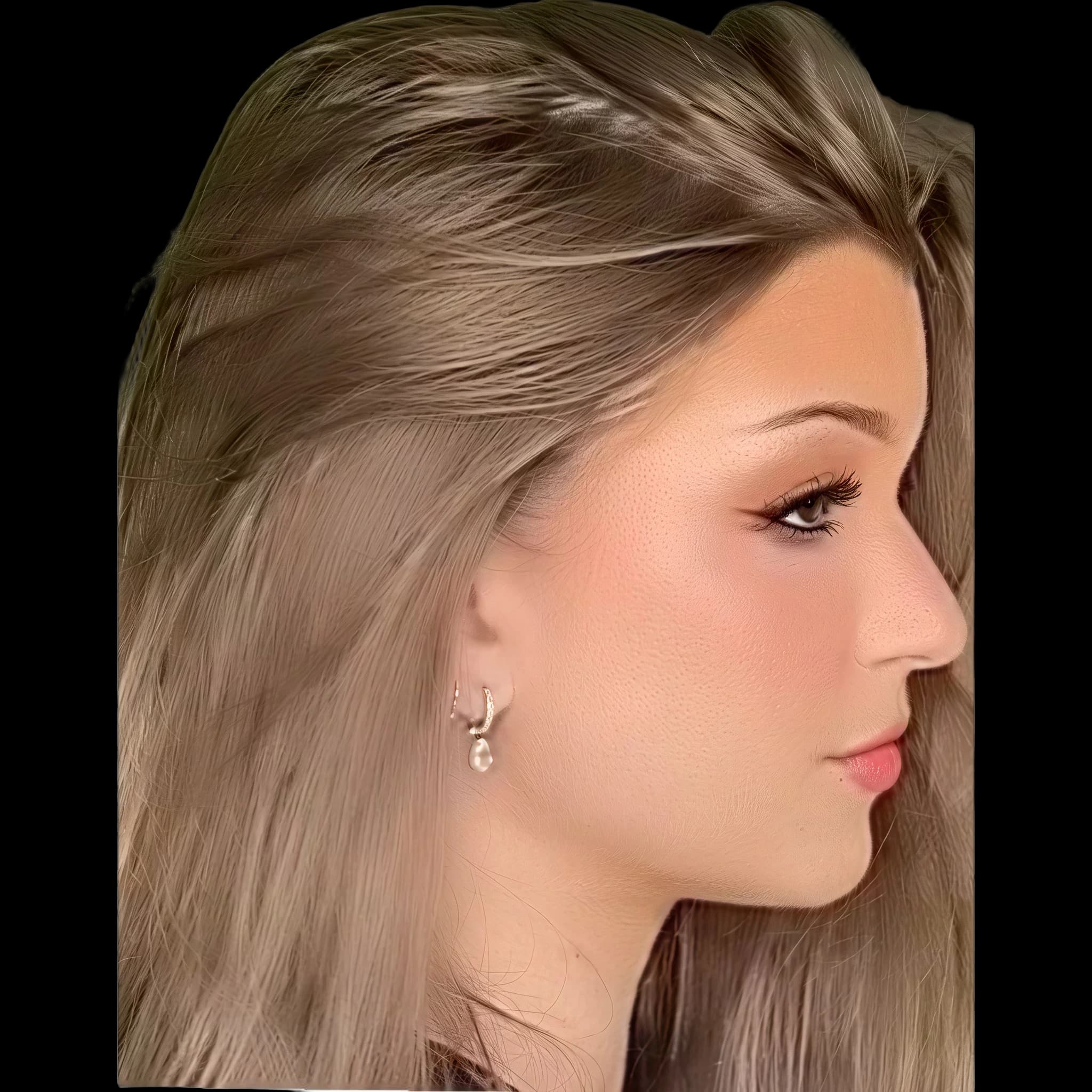 Brooke Monk, Submental Cervical Angle