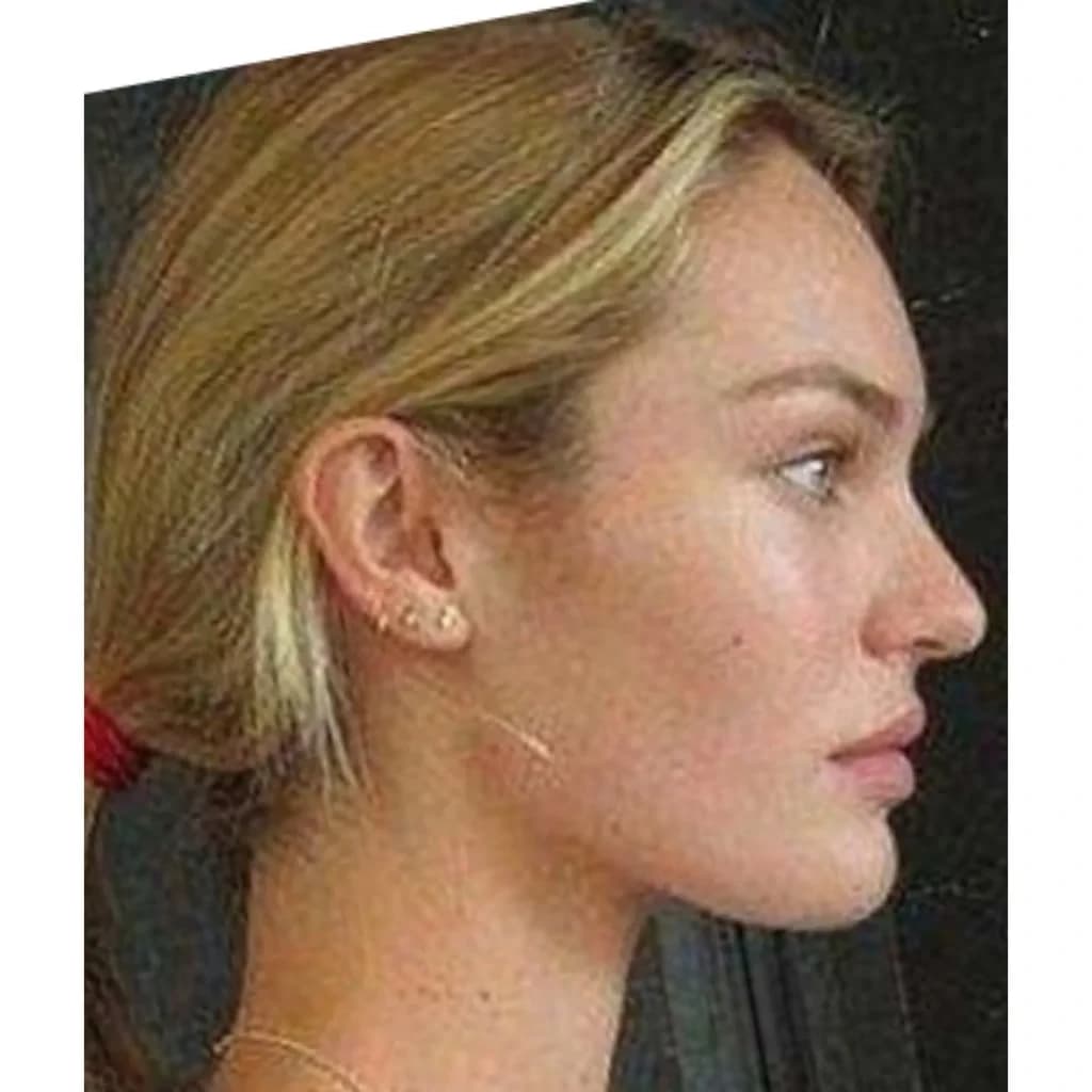 Candice Swanepoel