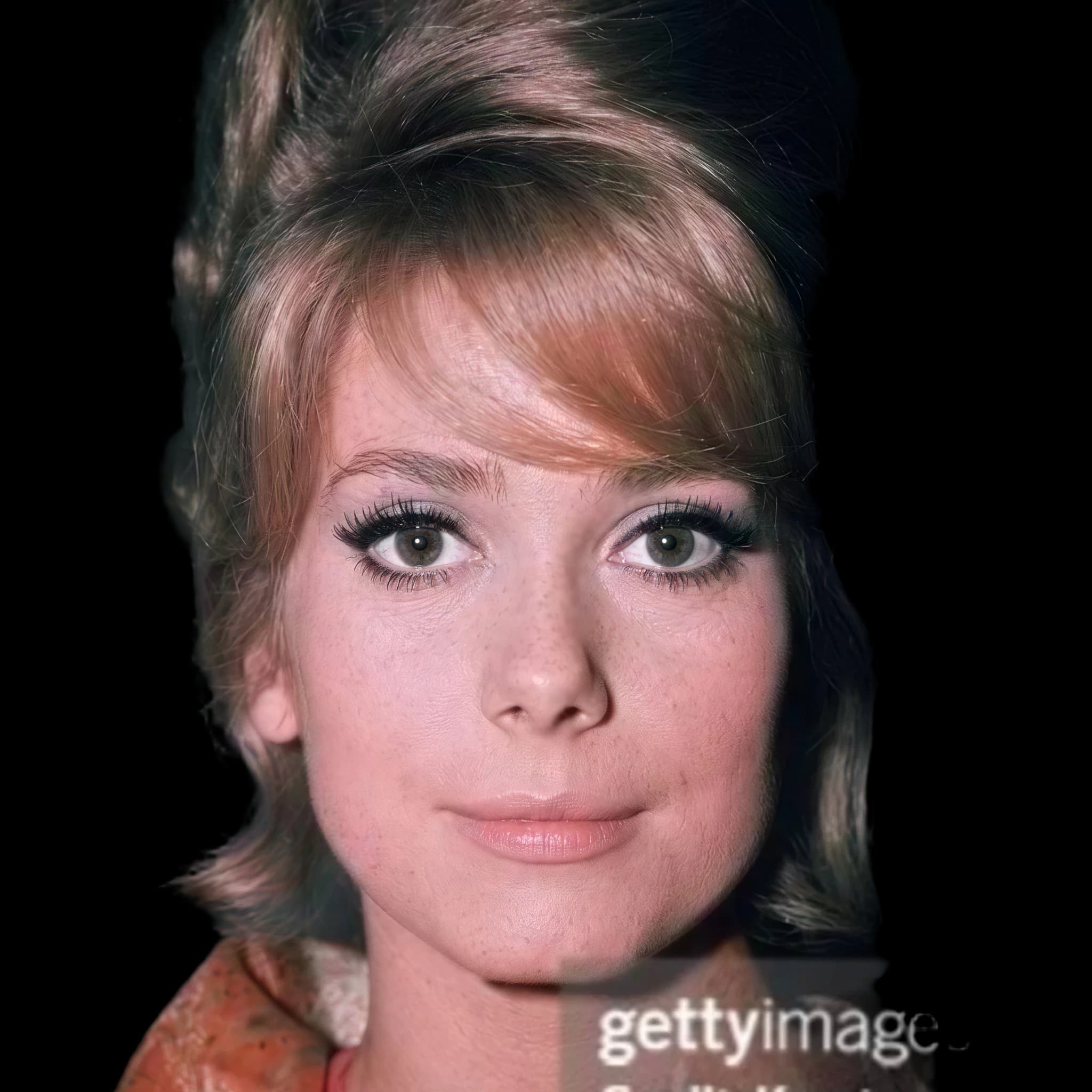 Catherine Deneuve, Mentolabial Creasing