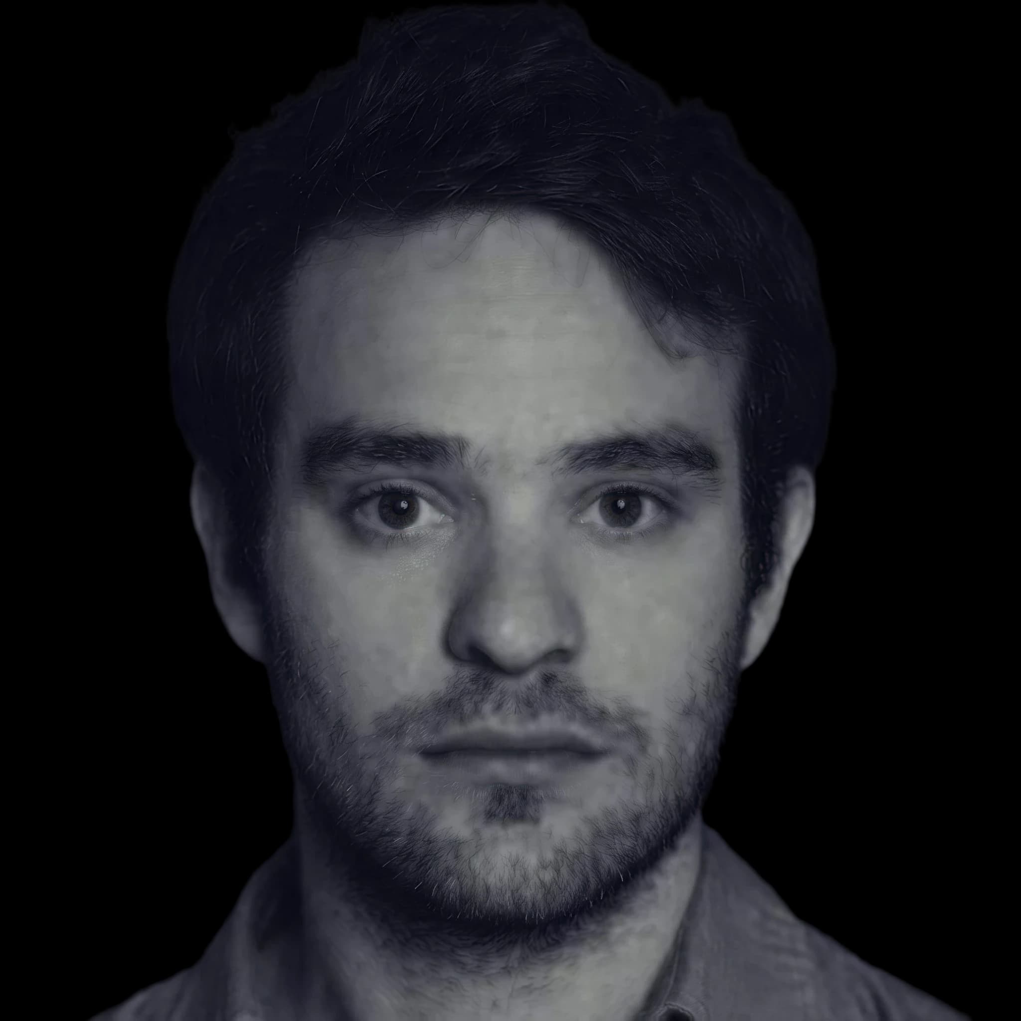 Charlie Cox, Cheekbone Prominence
