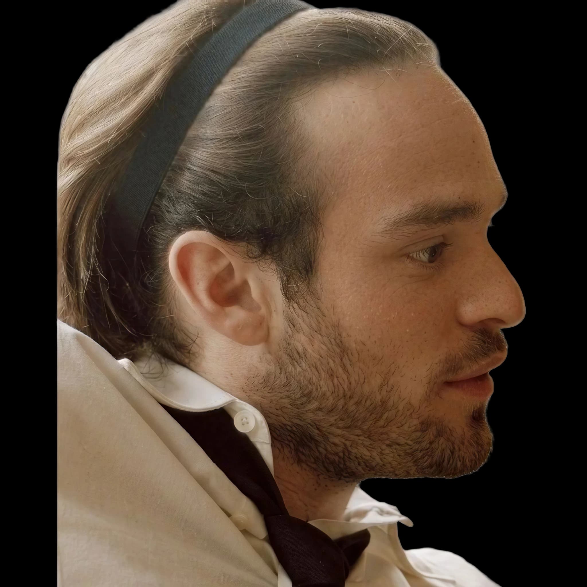 Charlie Cox, Mandibular Plane Angle