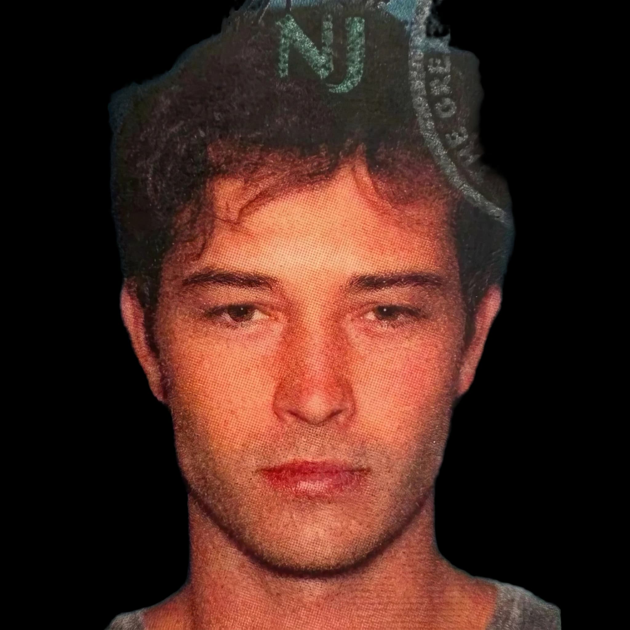 Chico Lachowski (current), Eczema
