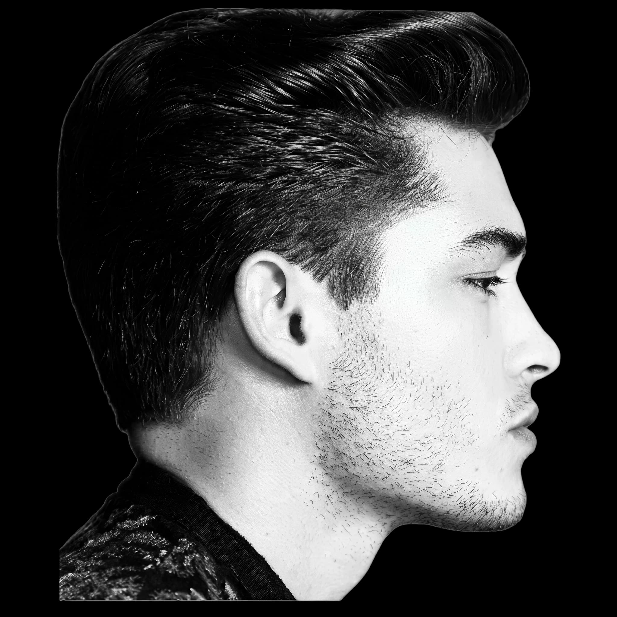 Chico Lachowski (teen), Upper Lip E-Line Position