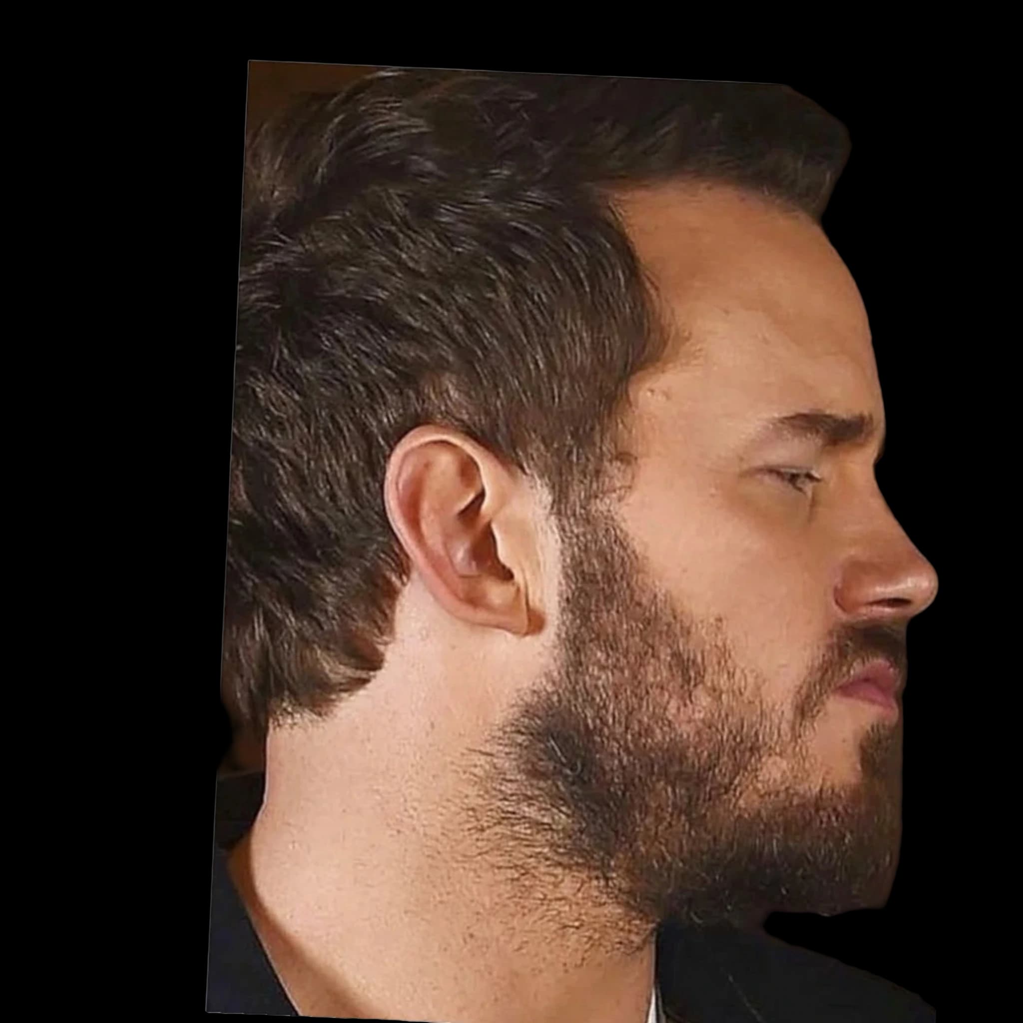 Chris Patt, Nasomental Angle