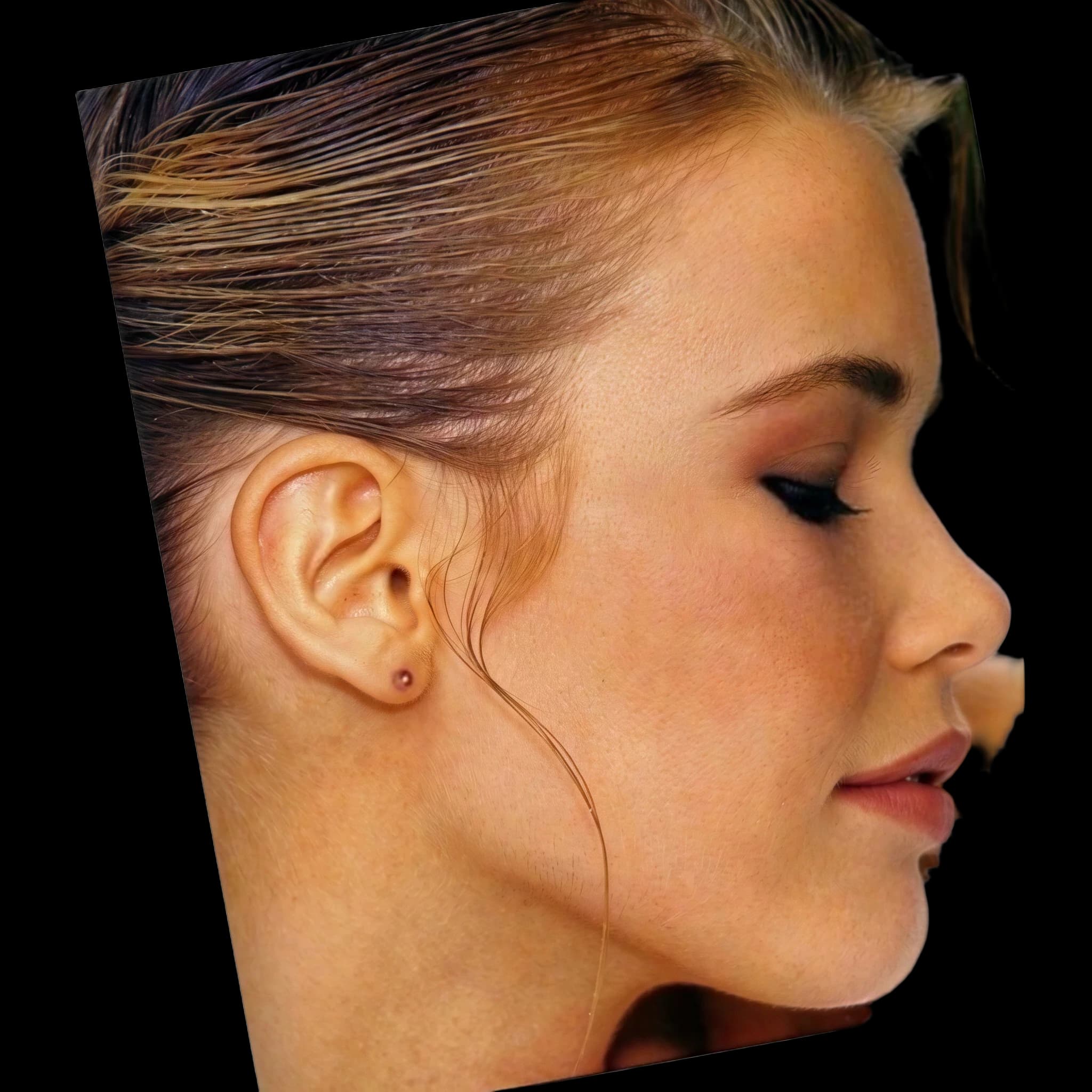 Claudia Schiffer, Submental Definition