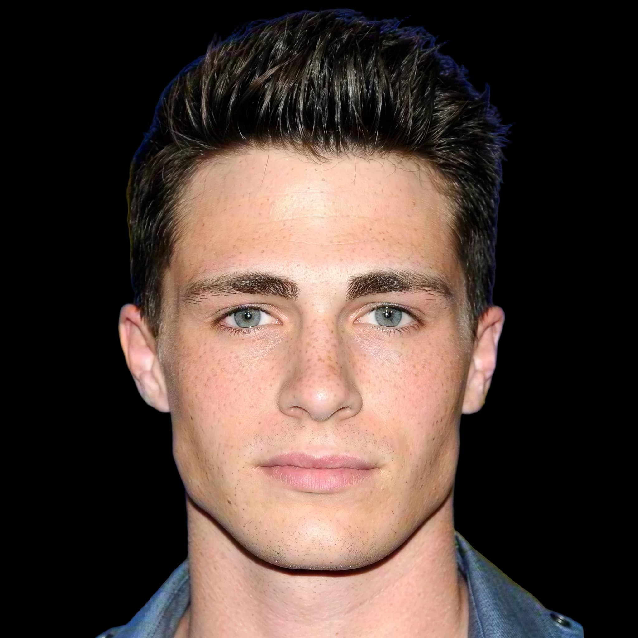 Colton Haynes, Hyperpigmentation