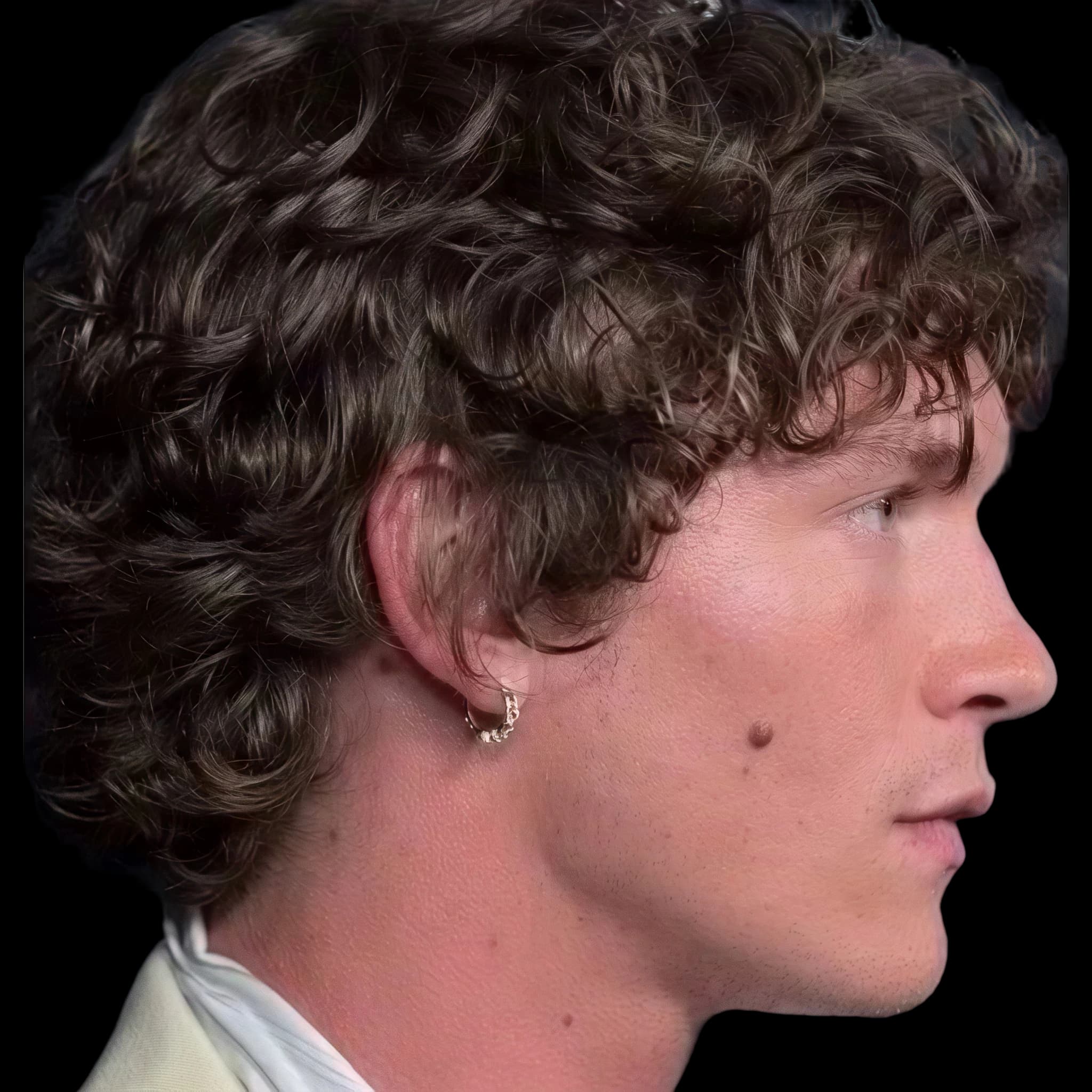 Connor Storrie, Upper Lip S-Line Position