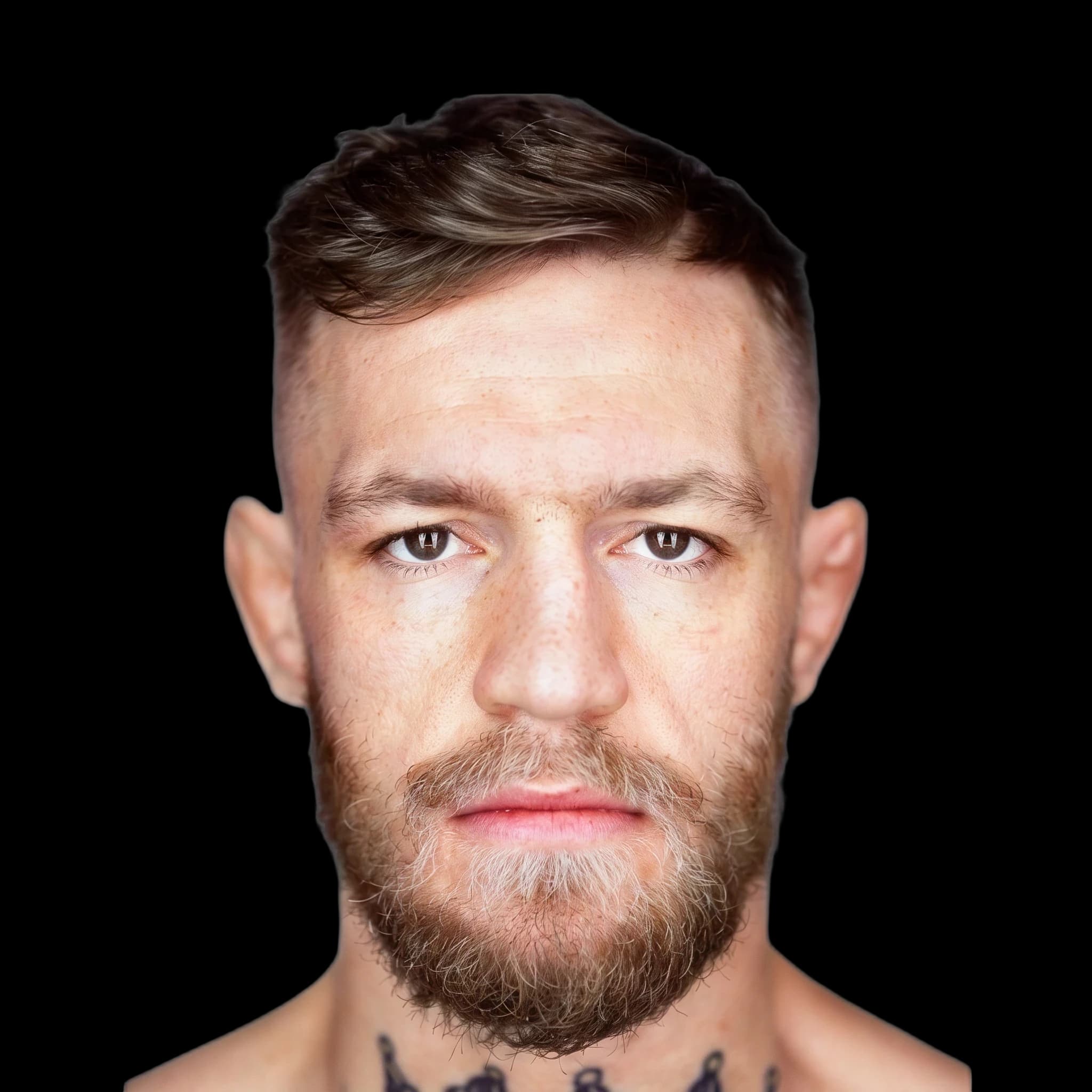 Conor Mcgregor, Jaw Definition