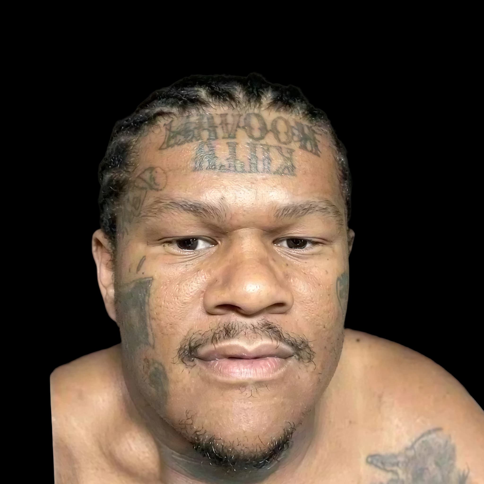 Crip Mac, Ipsilateral Alar Angle