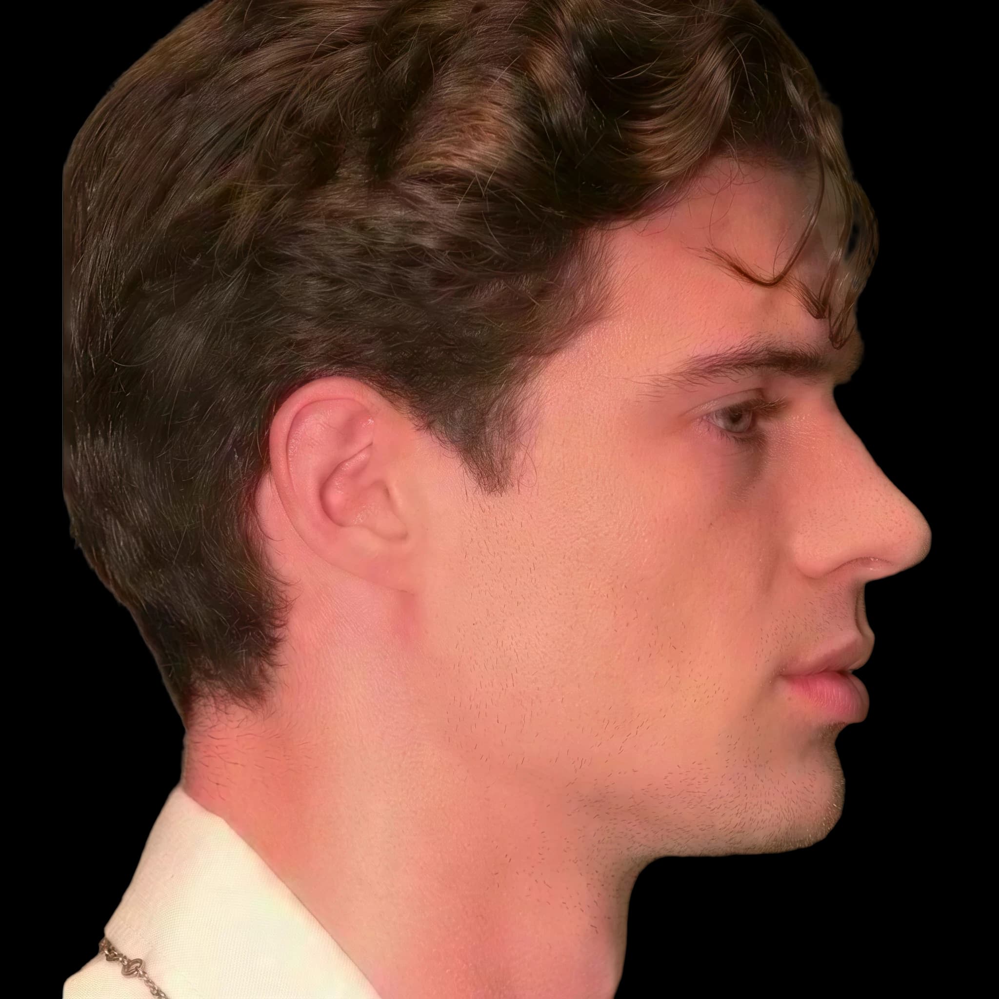 David Corenswet, Submental Cervical Angle