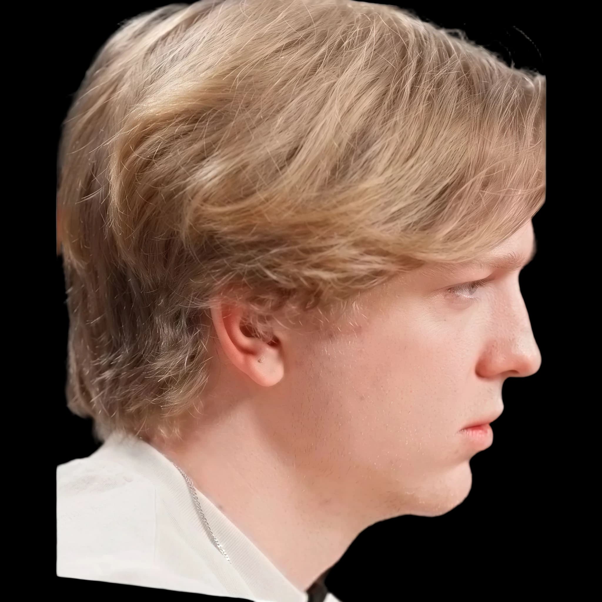 Dean Withers, Gonial Angle