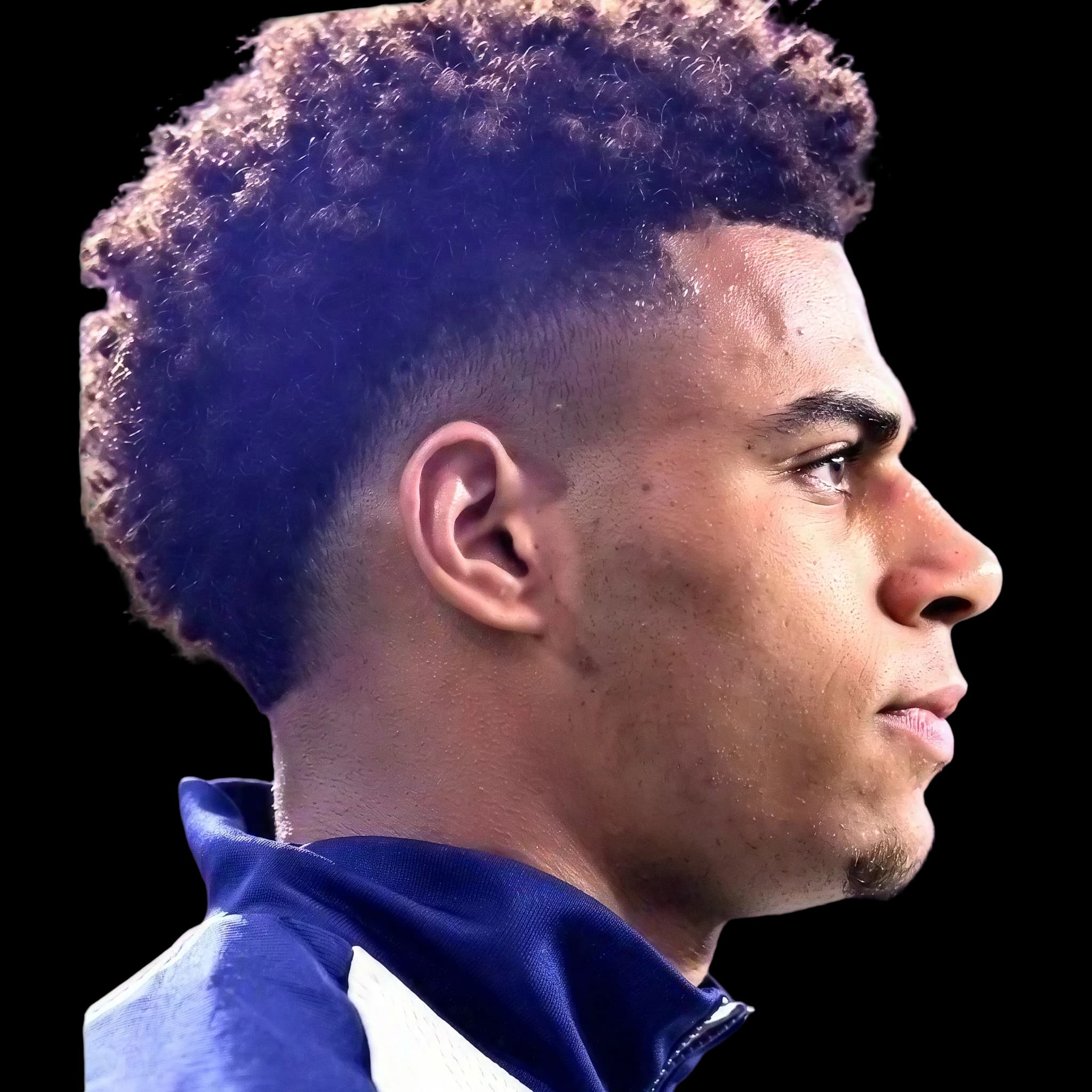 Désiré Doué, Mentolabial Angle