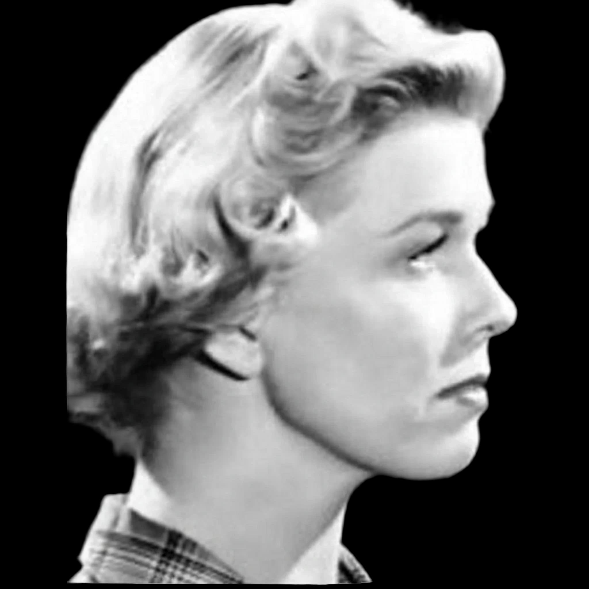Doris Day, Submental Definition