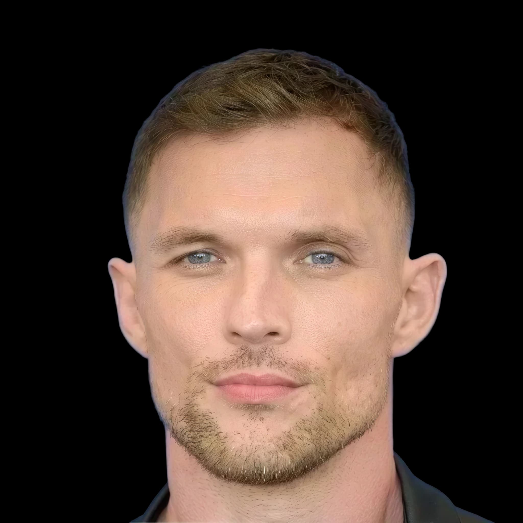 Ed Skrein, Hyperpigmentation