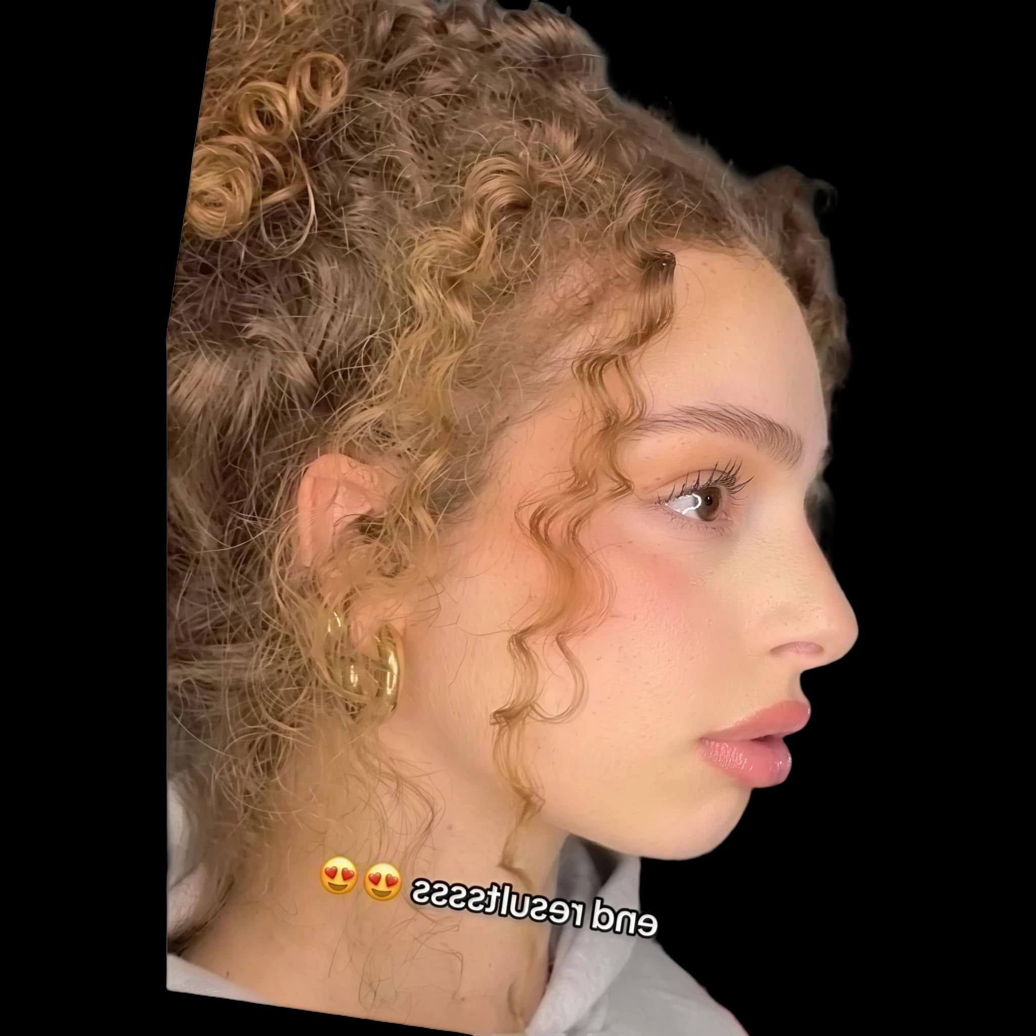 Eliana Kalogeras, Submental Definition