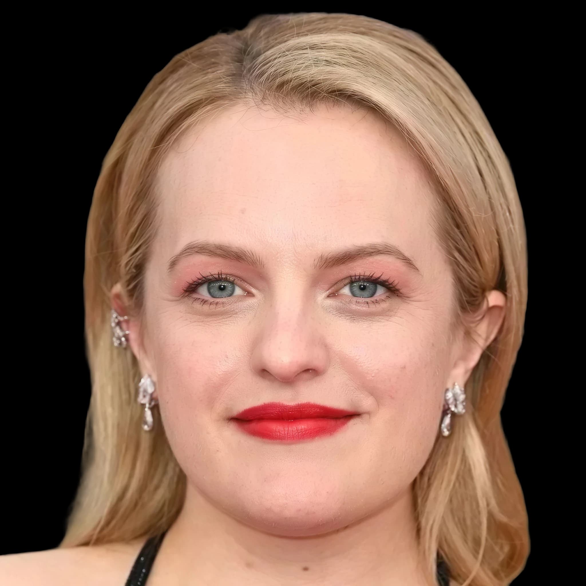 Elizabeth Moss, Hyperpigmentation