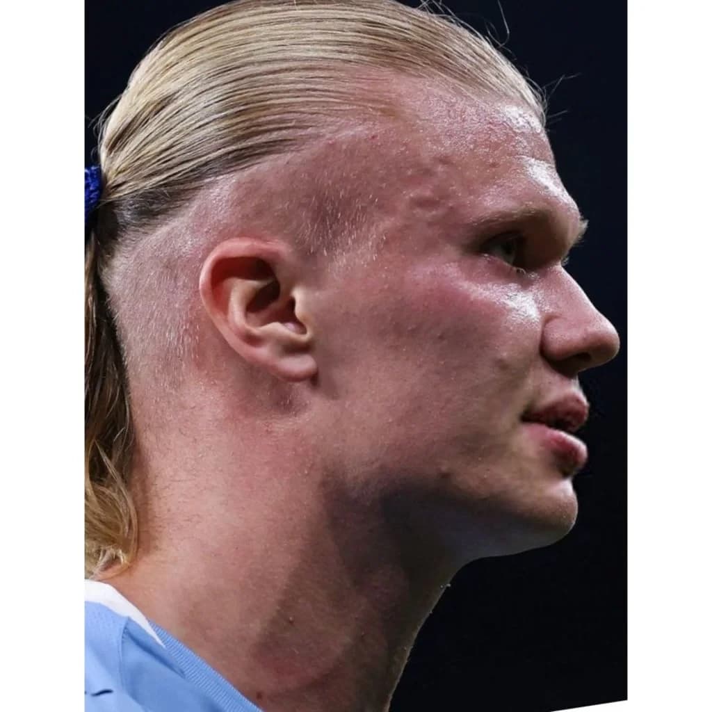 Erling Haaland