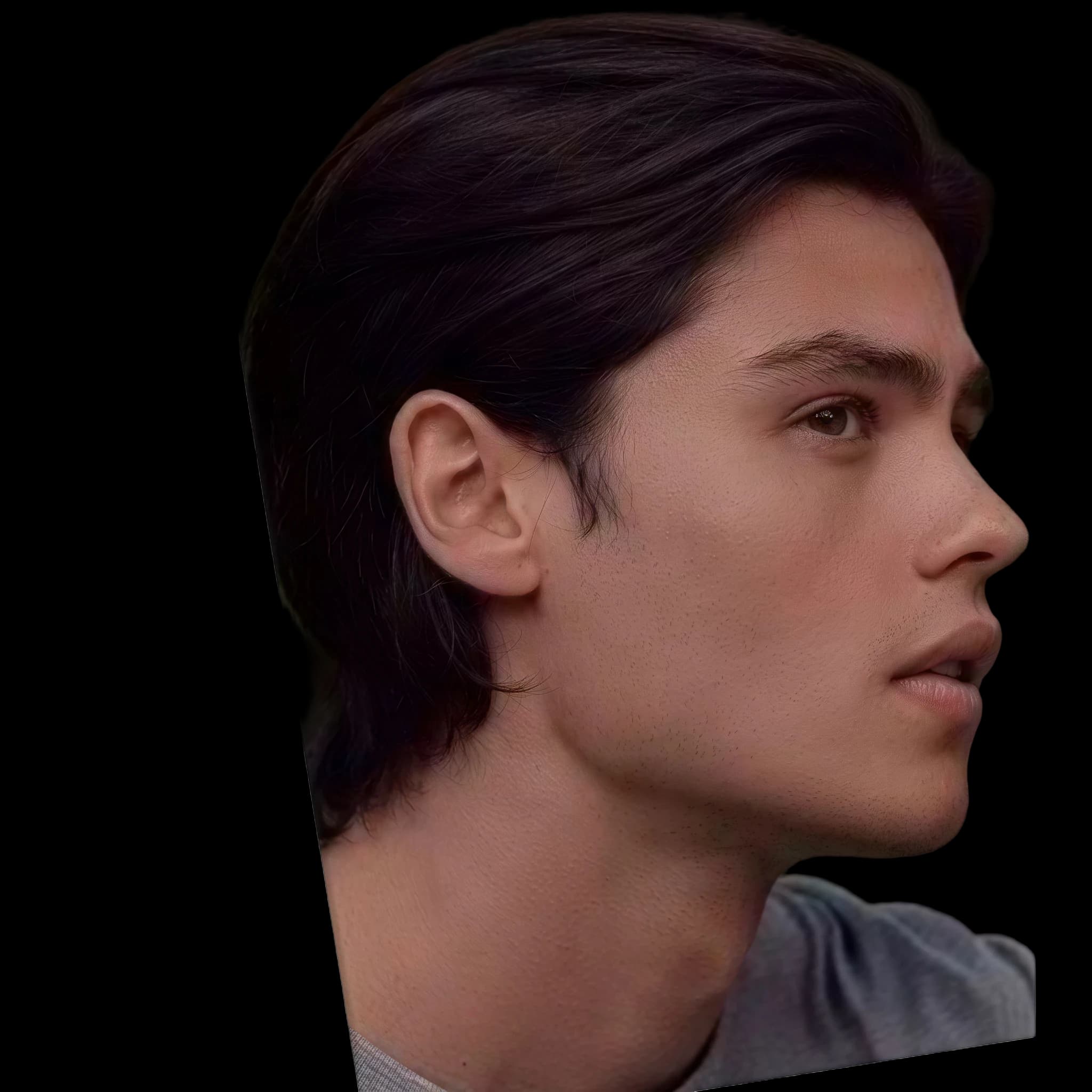 Felix Mallard, Interior Midface Projection Angle