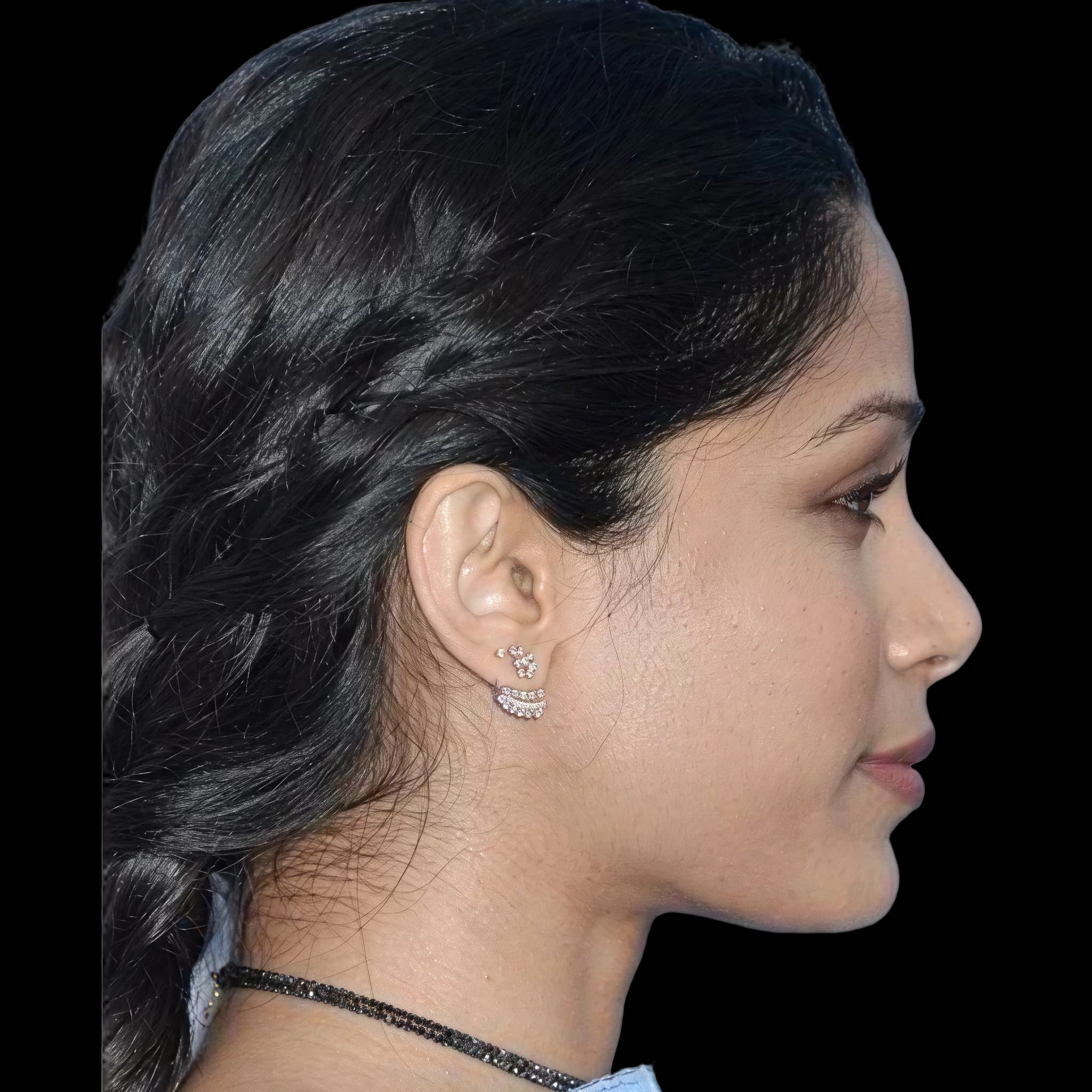 Freida Pinto, Submental Definition