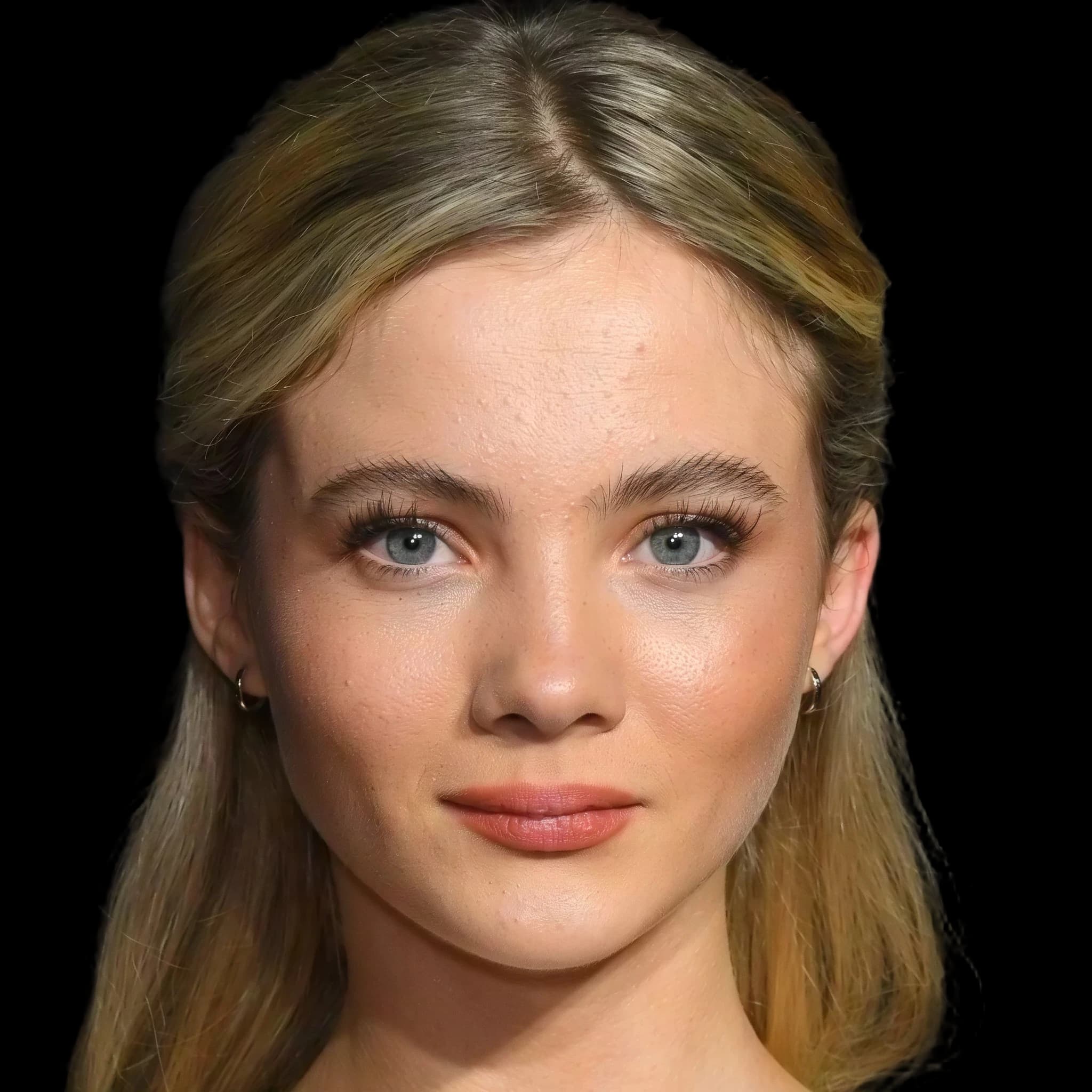 Freya Allan, Hyperpigmentation