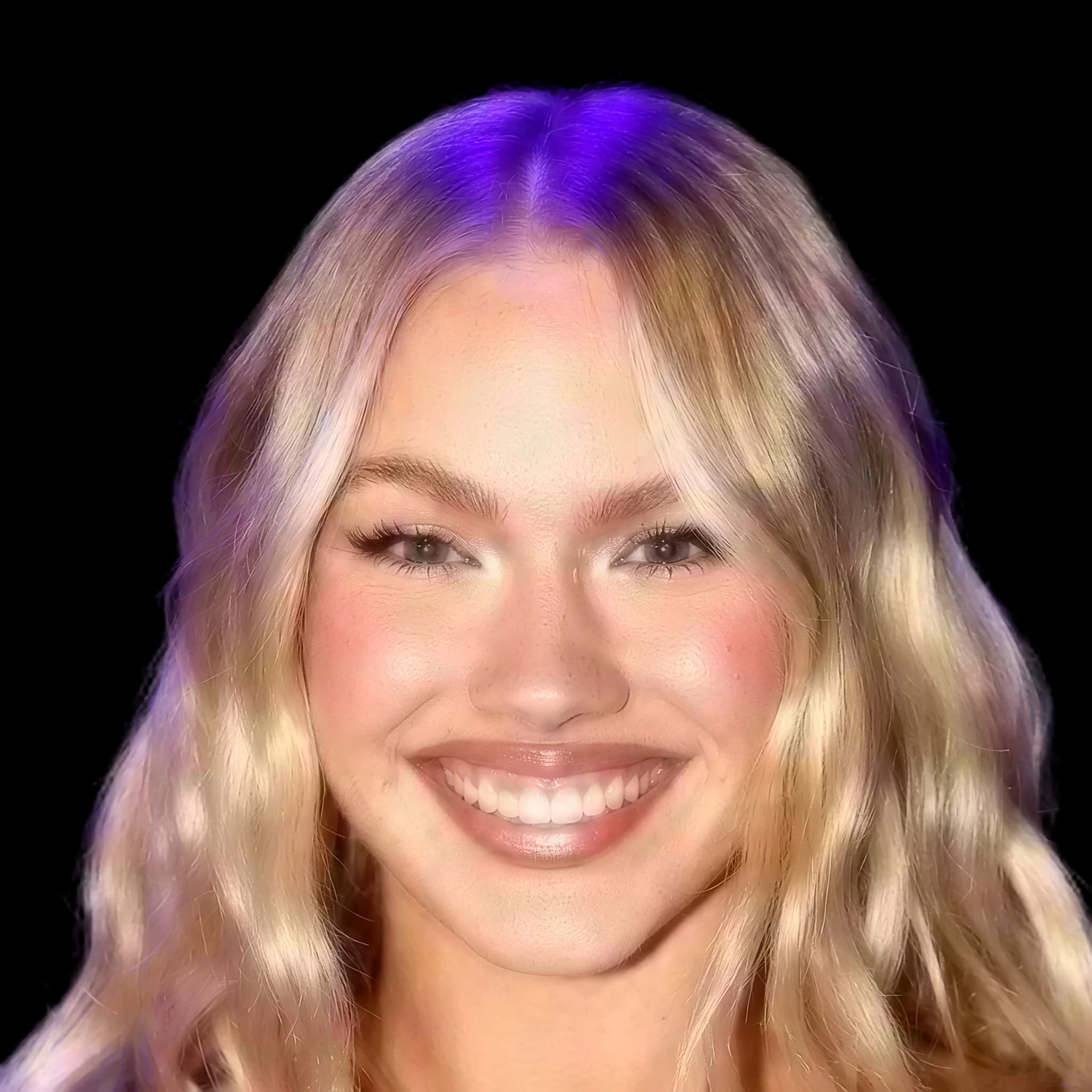 Freya Skye, Hyperpigmentation
