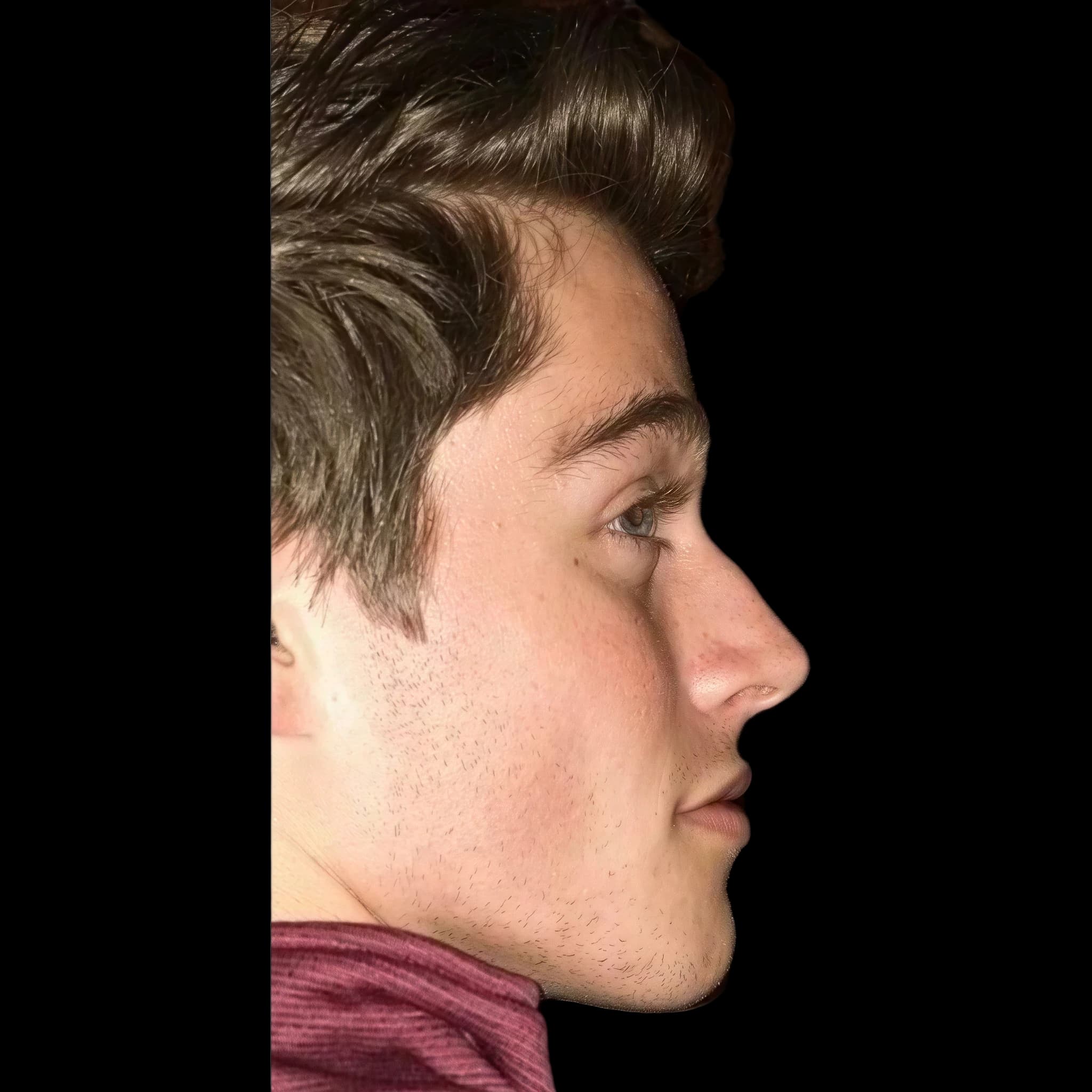 Froy Guiterrez, Submental Definition