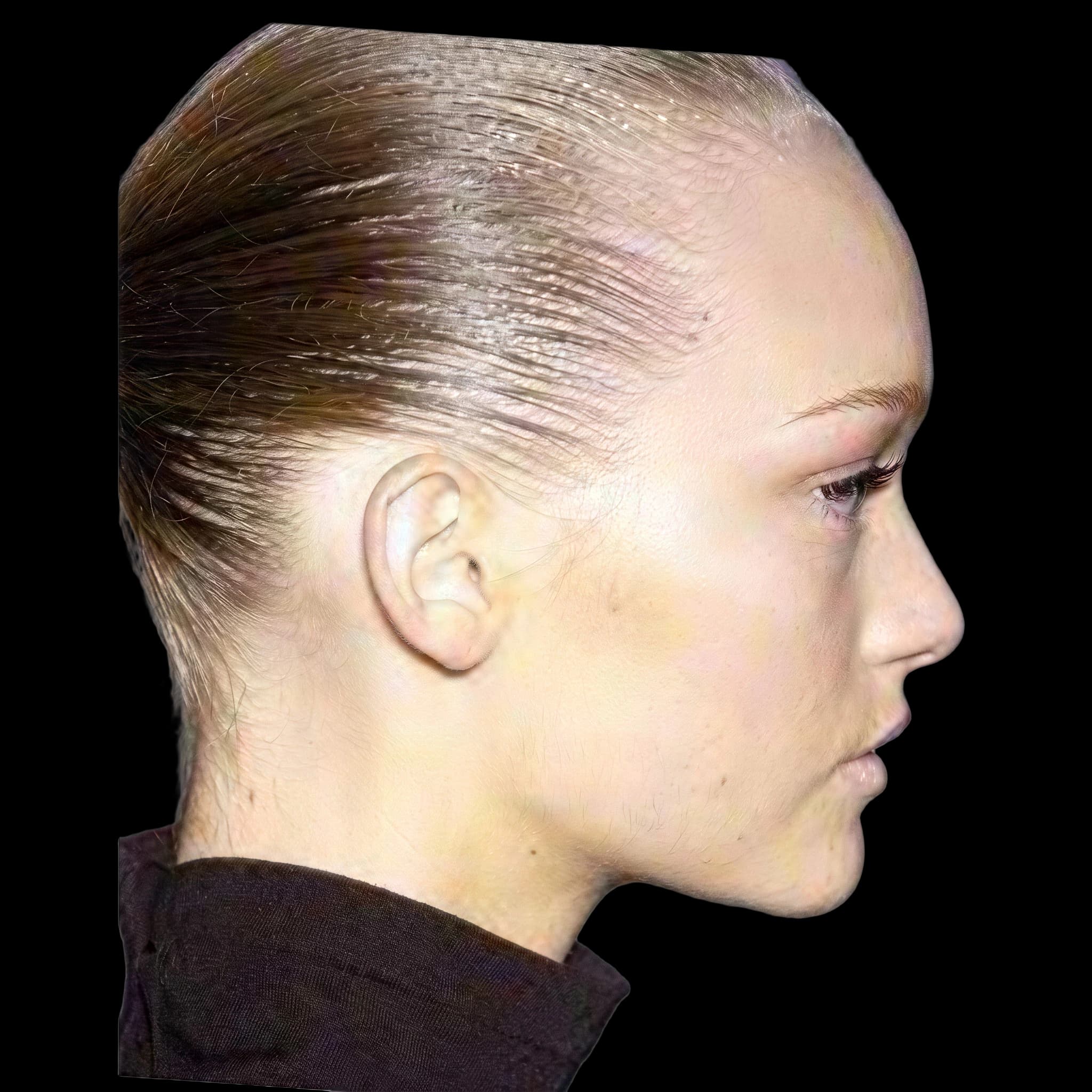 Gemma Ward, Submental Definition